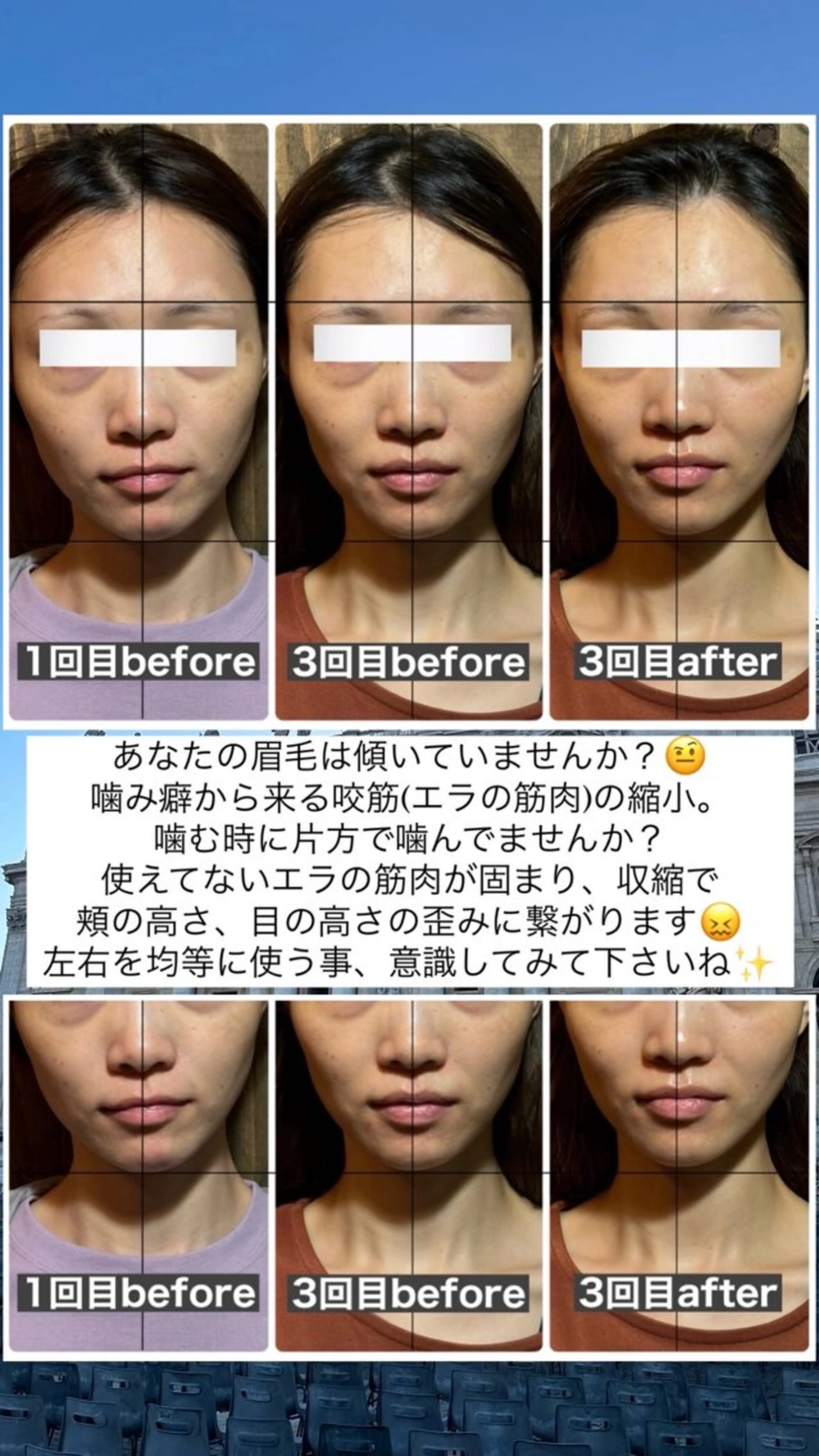 エステ リラク 💎後悔させない小顔 矯正💎イトヤマ🌱のエステ・リラクイメージ