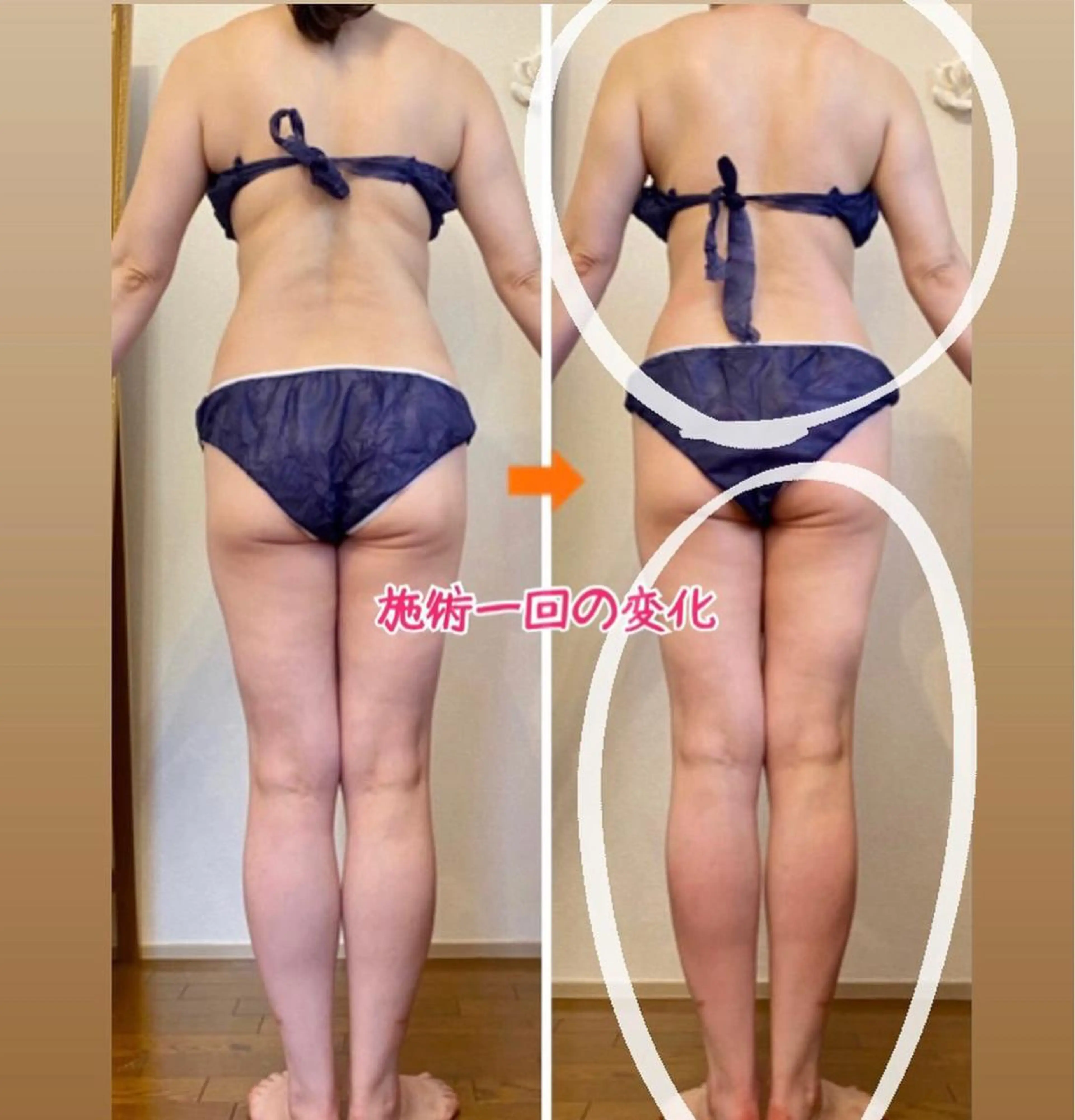 ショート カラー パーマ ヘアアレンジ メンズ キッズ ネイル マツエク・マツパ エステ リラク ‍痩身＆ボディ 結果出し🌟丹野のエステ・リラクイメージ