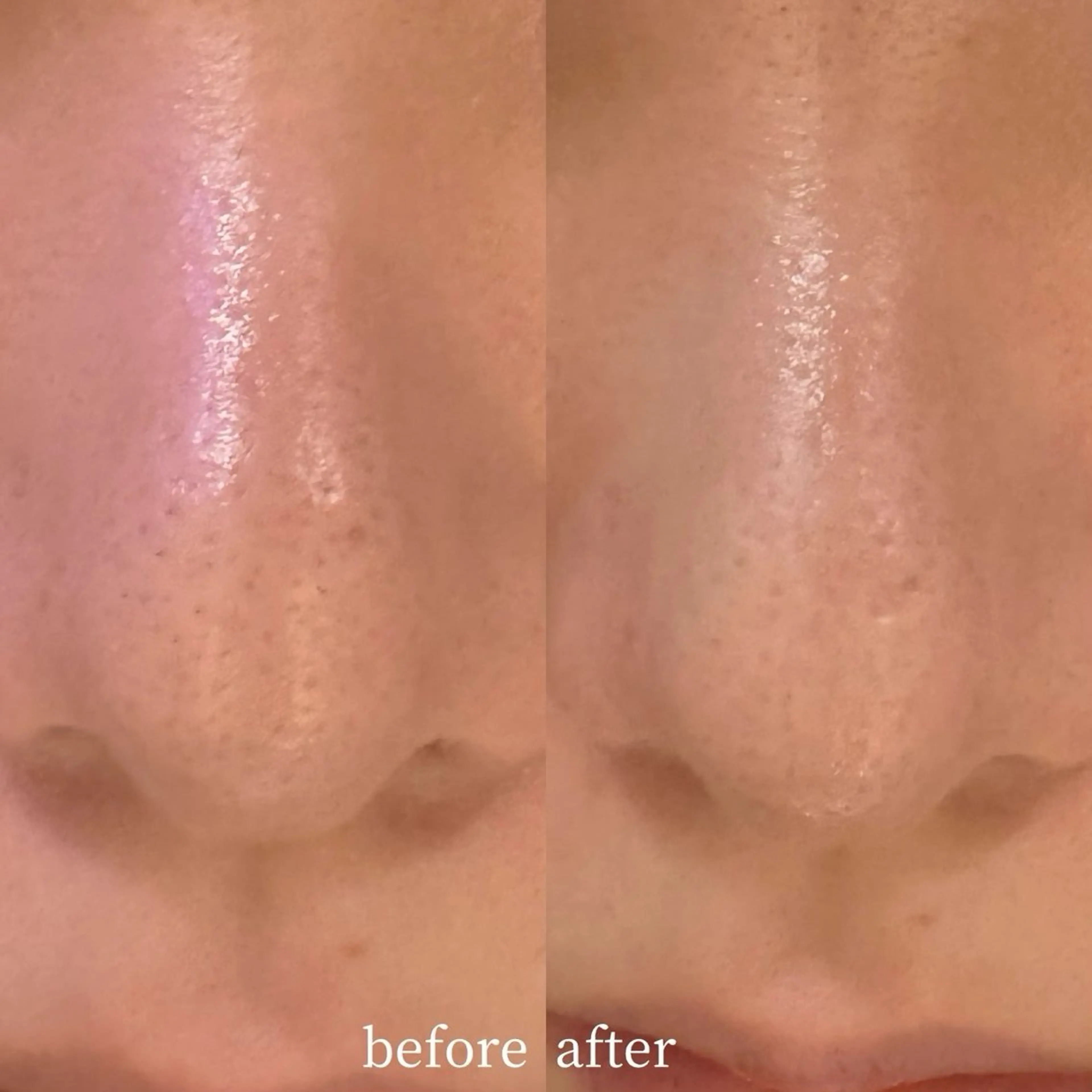 渋谷ベルゼ🌷木下 毛穴/脱毛/フェムのその他イメージ