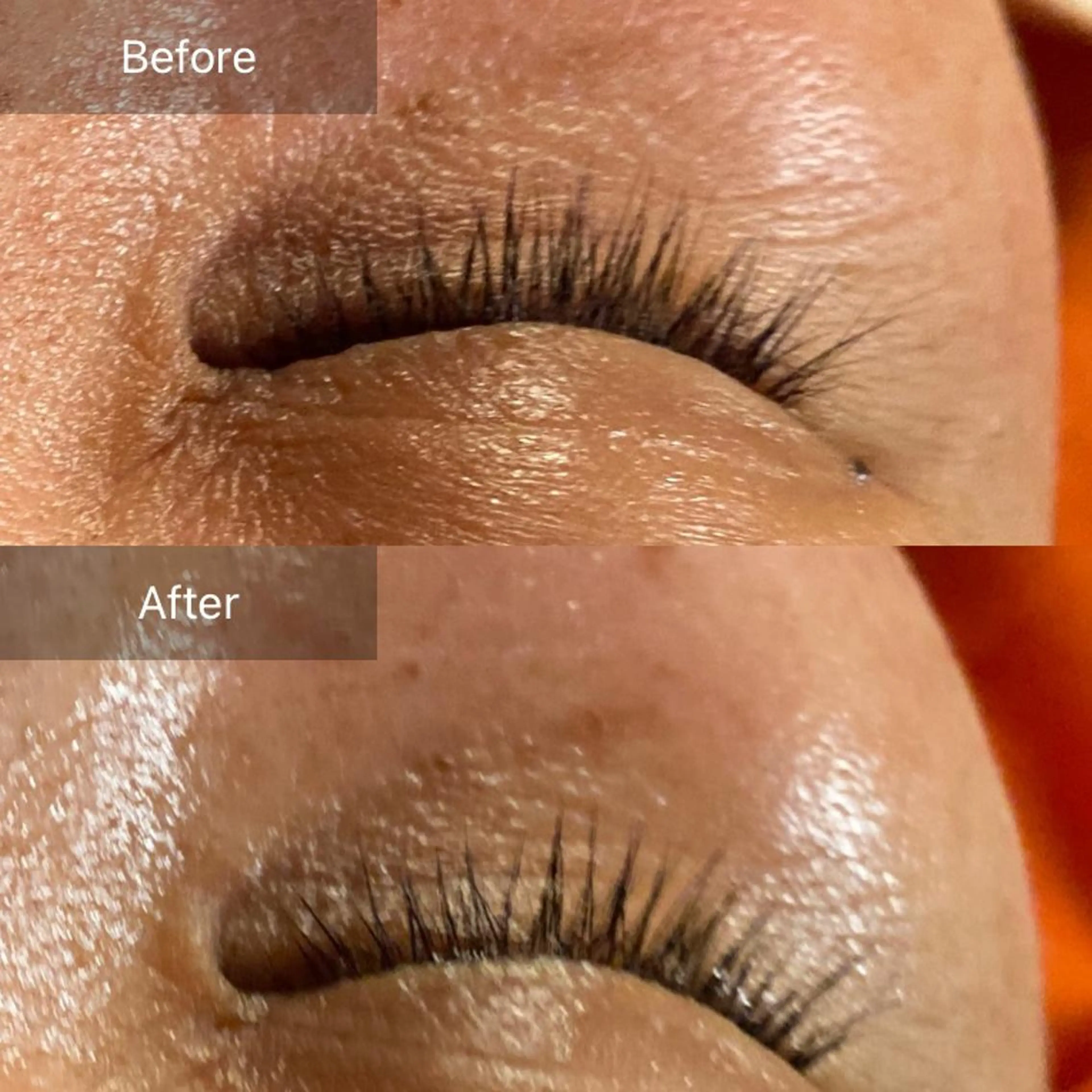 毛穴から始める肌メン テマンダリンオレンジのエステ・リラクイメージ