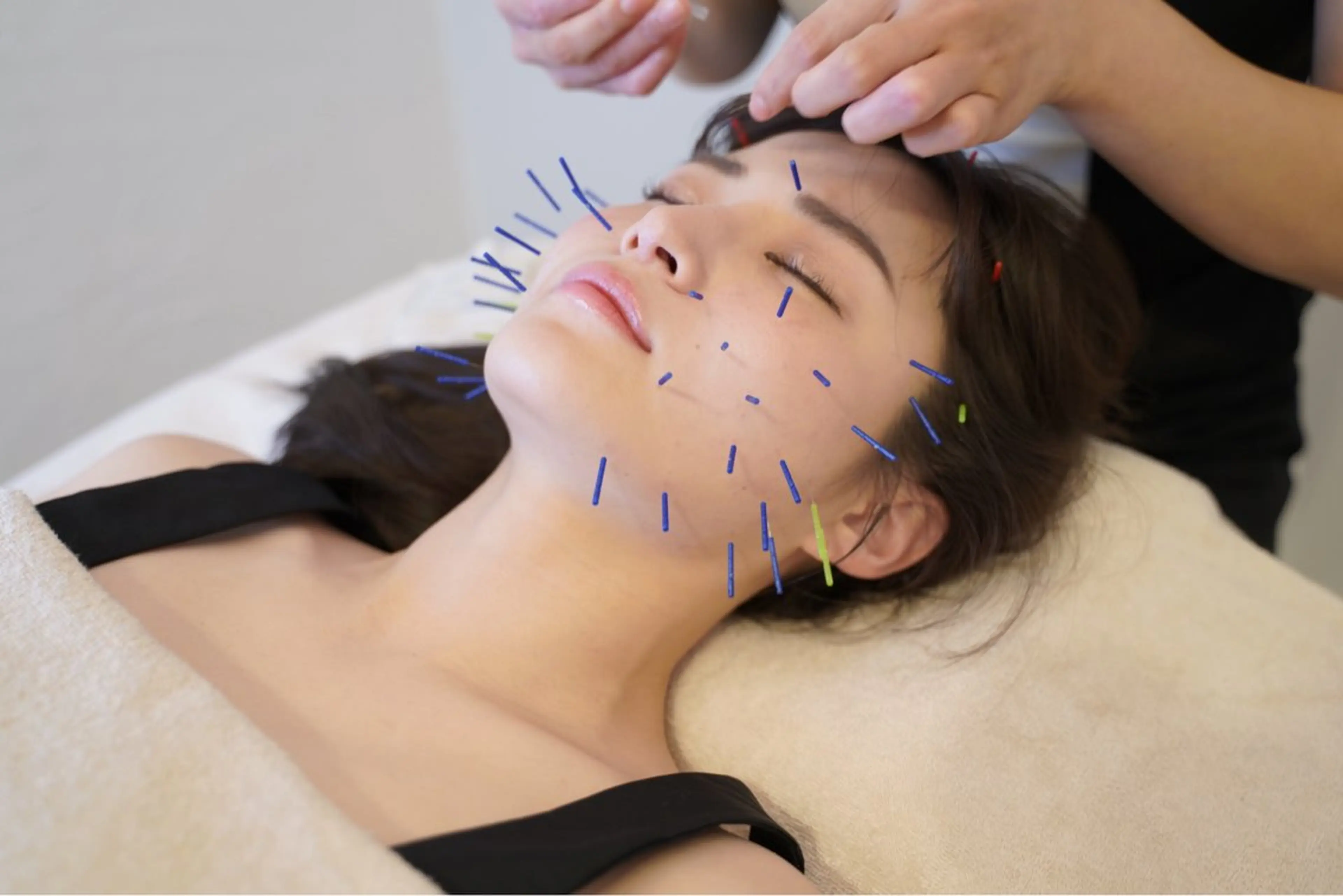 お試し鍼施術🔥スマホ、pc疲れ、眼精疲労ショートケアコース🪡✨30分/¥8.800の写真