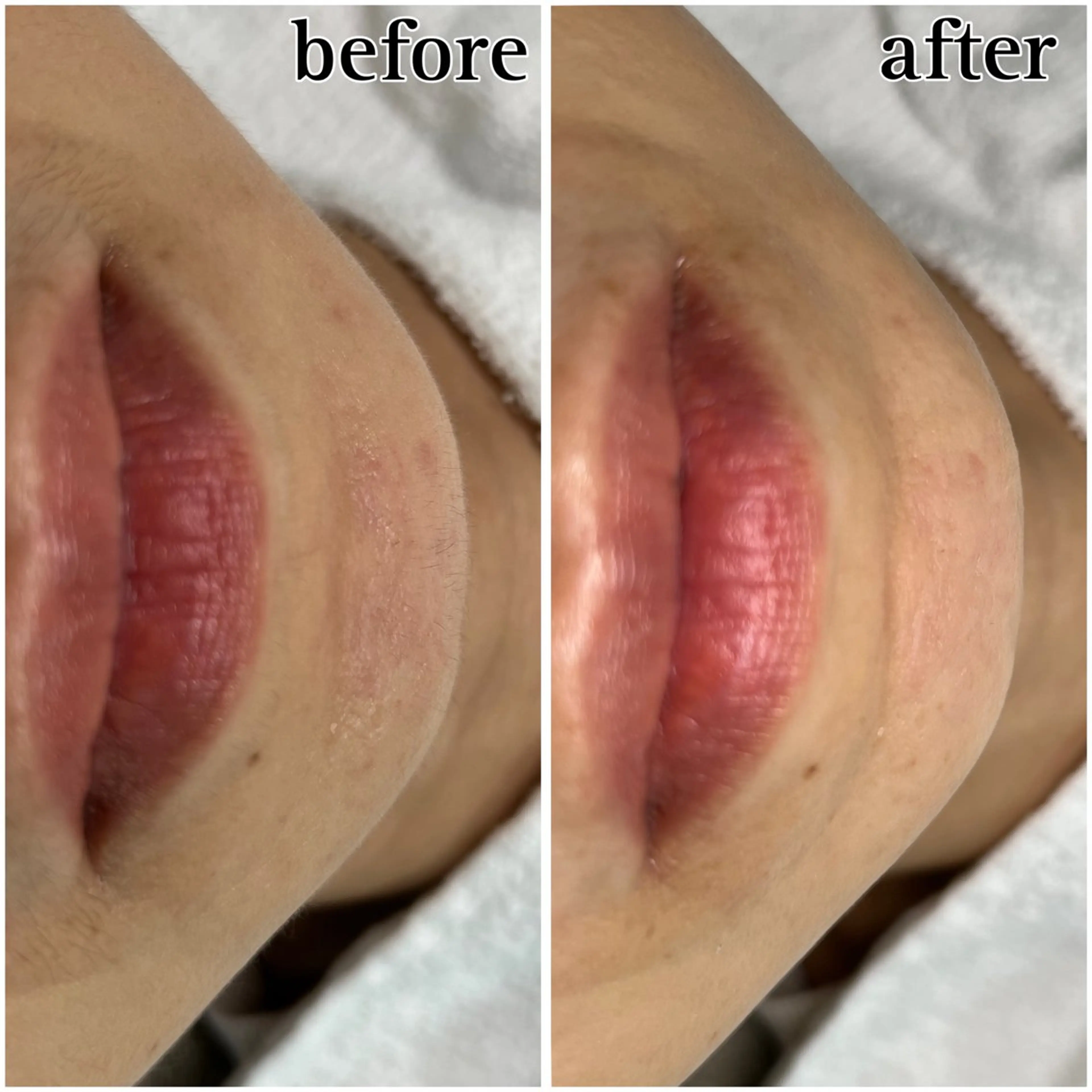 SHECIAお顔剃りシェービング専門店所属・お顔剃りエステサロン SHECIAのその他イメージ