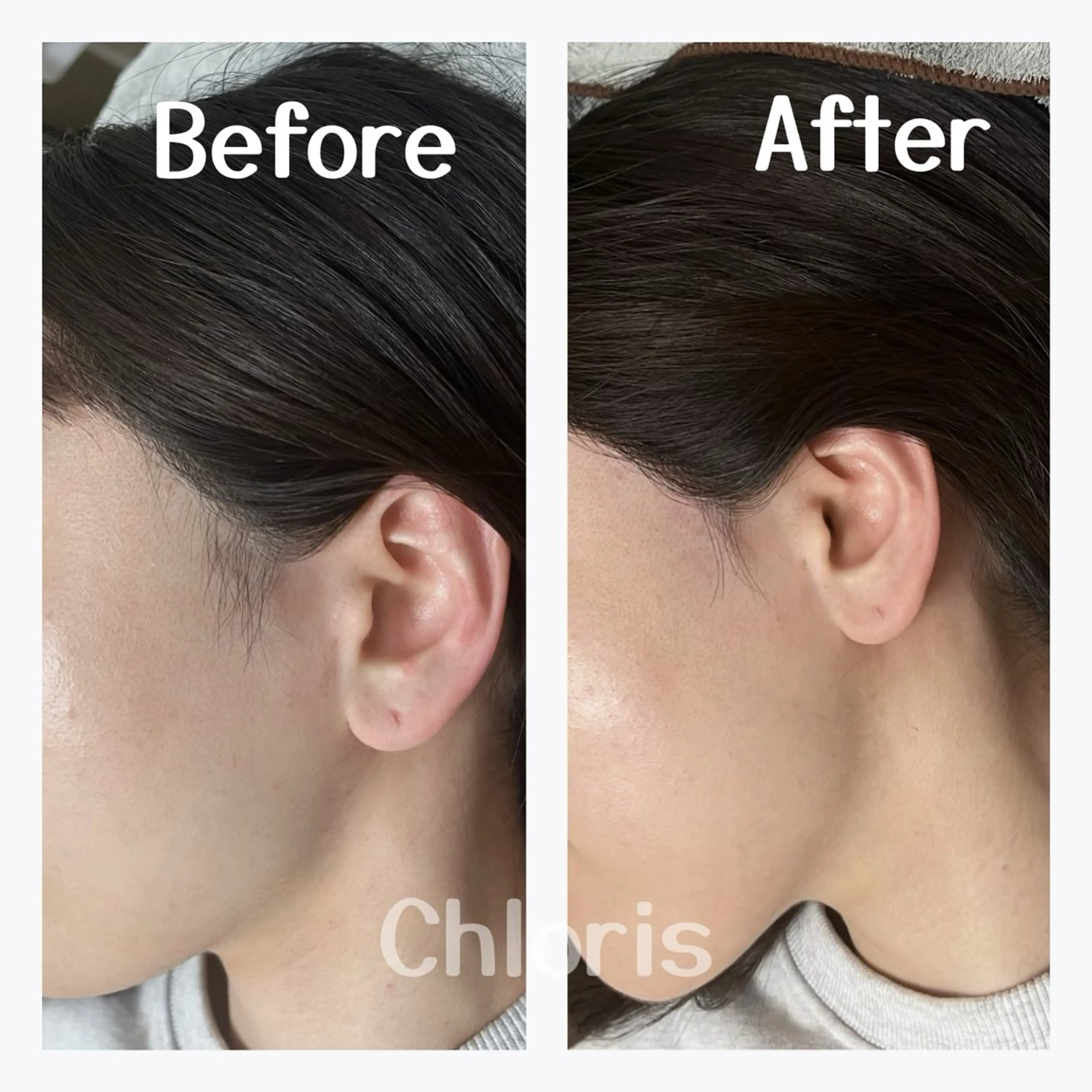 川越デリケートゾーン 光脱毛/ワックス脱毛のエステ・リラクイメージ