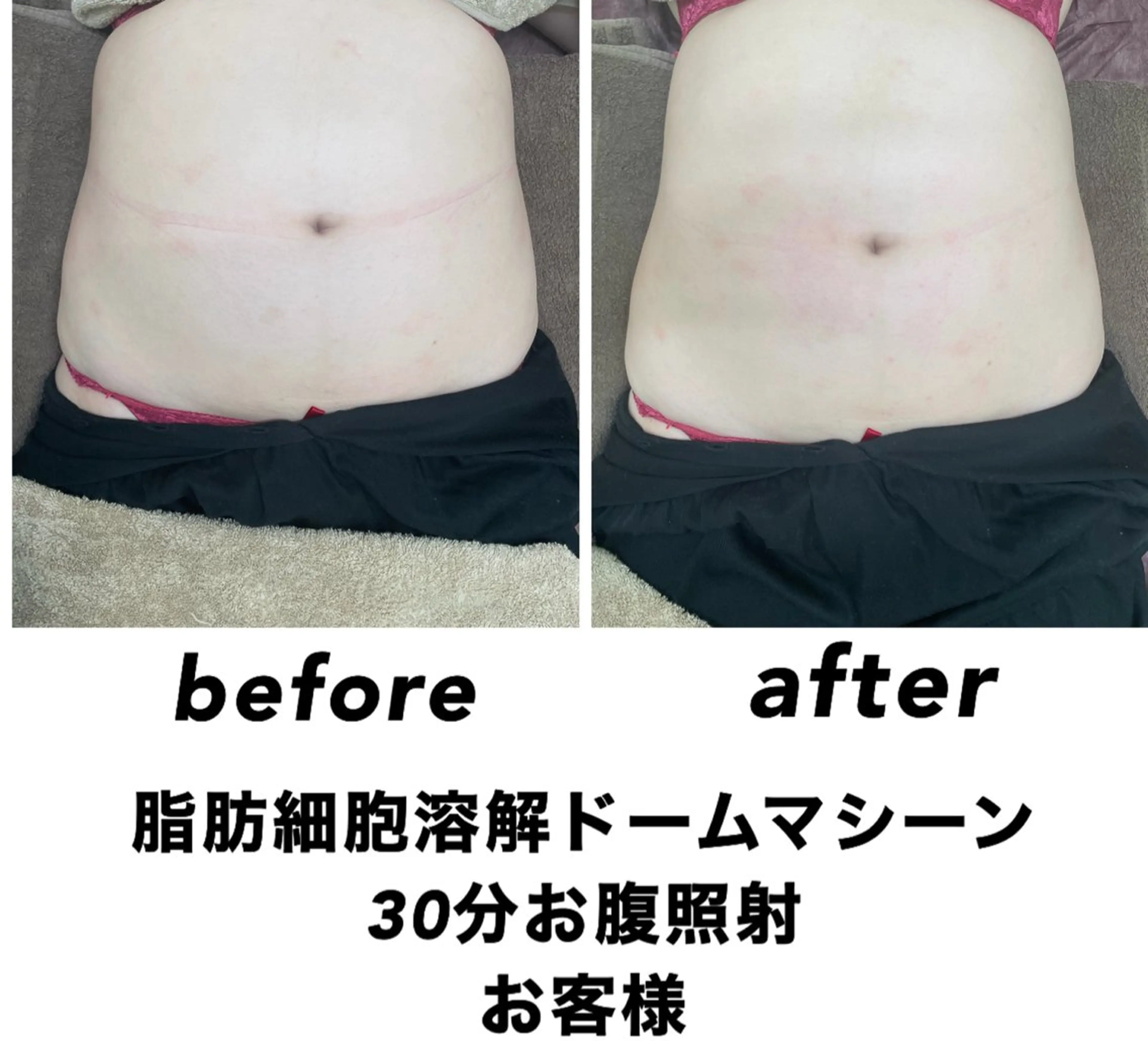 エステ ネイル・エステサロン UILANIのネイルデザイン