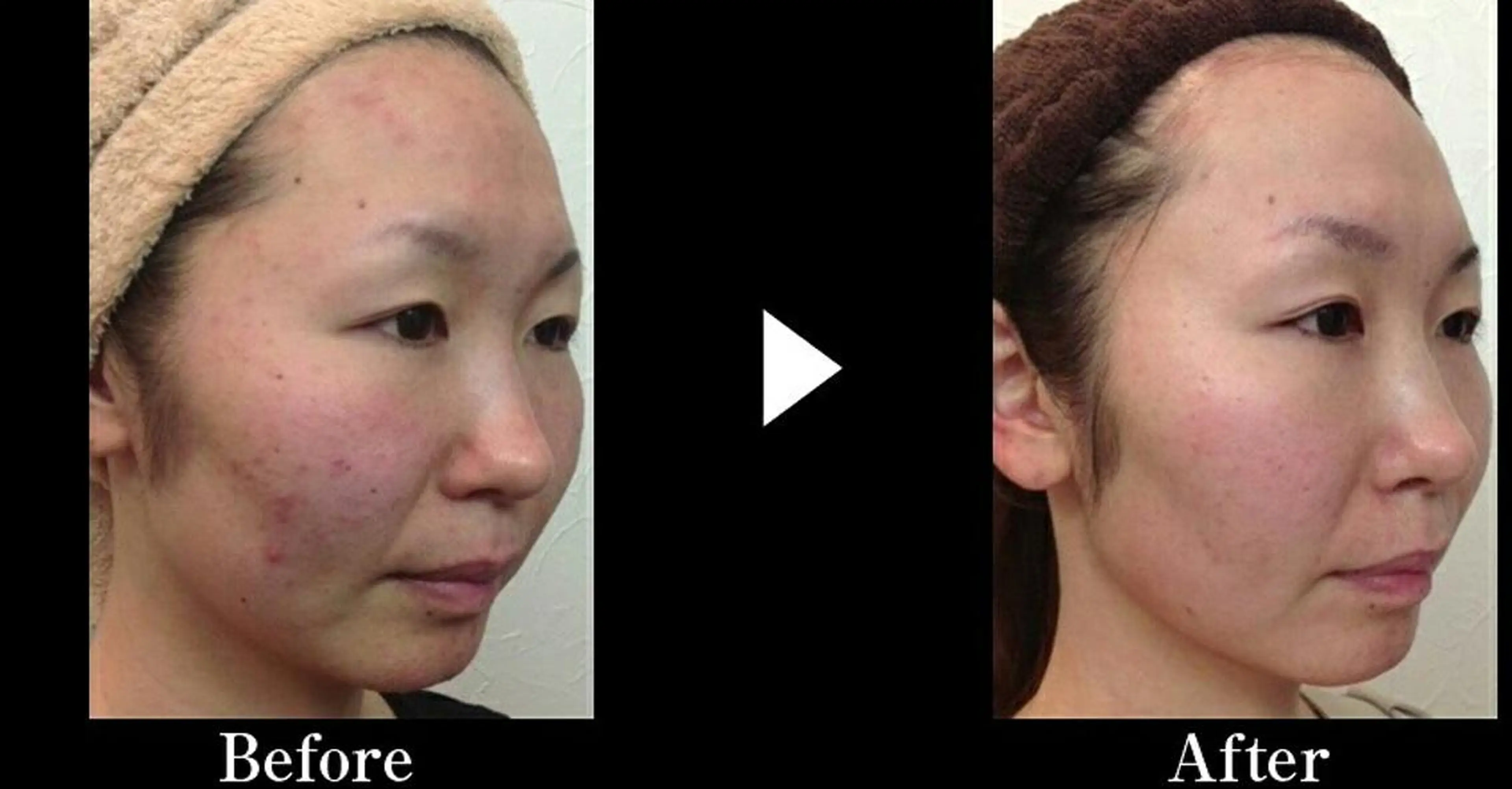 次世代まつげパーマは 『リベル名古屋』のマツエク・マツパデザイン