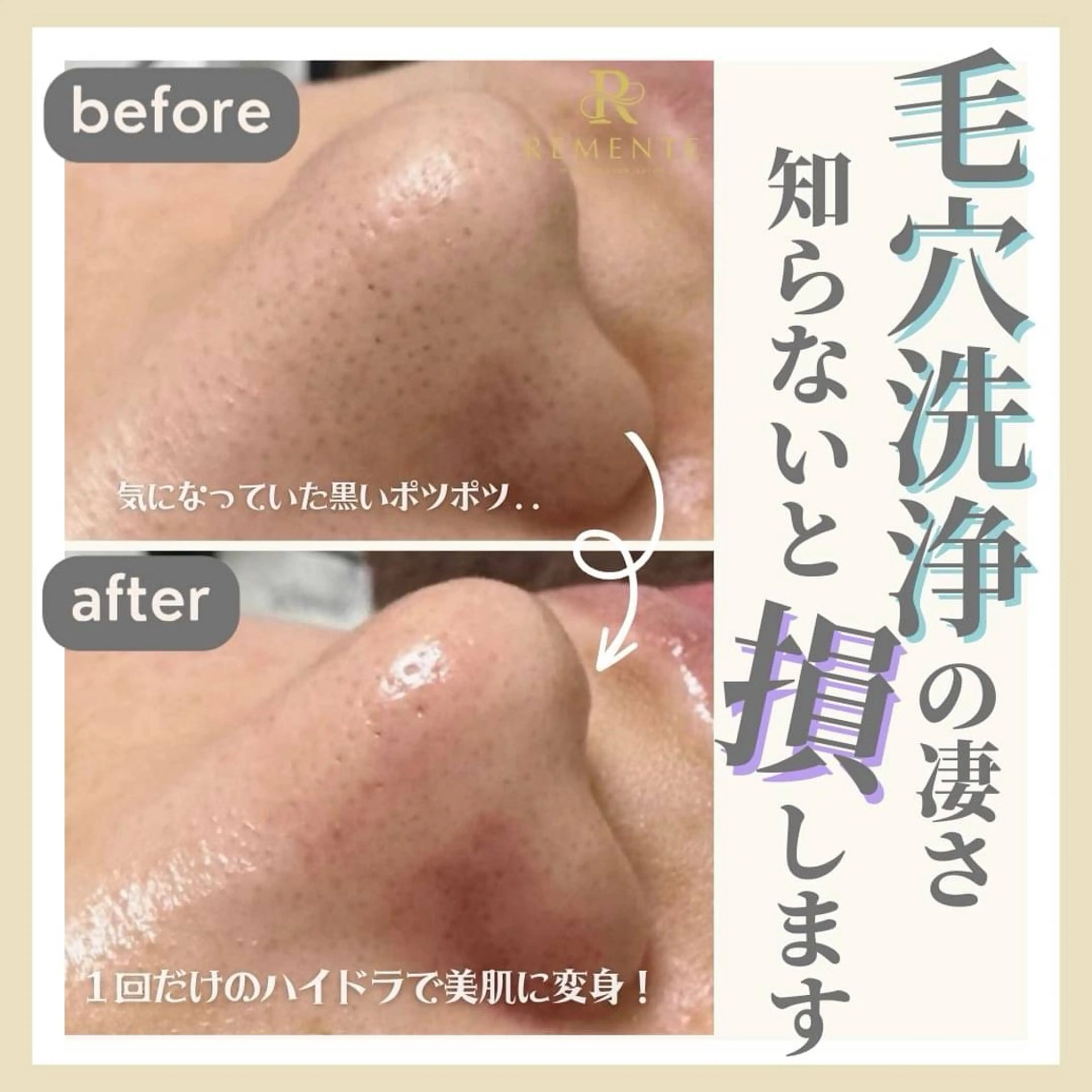 ISKAGO/ chisatoのエステ・リラクイメージ