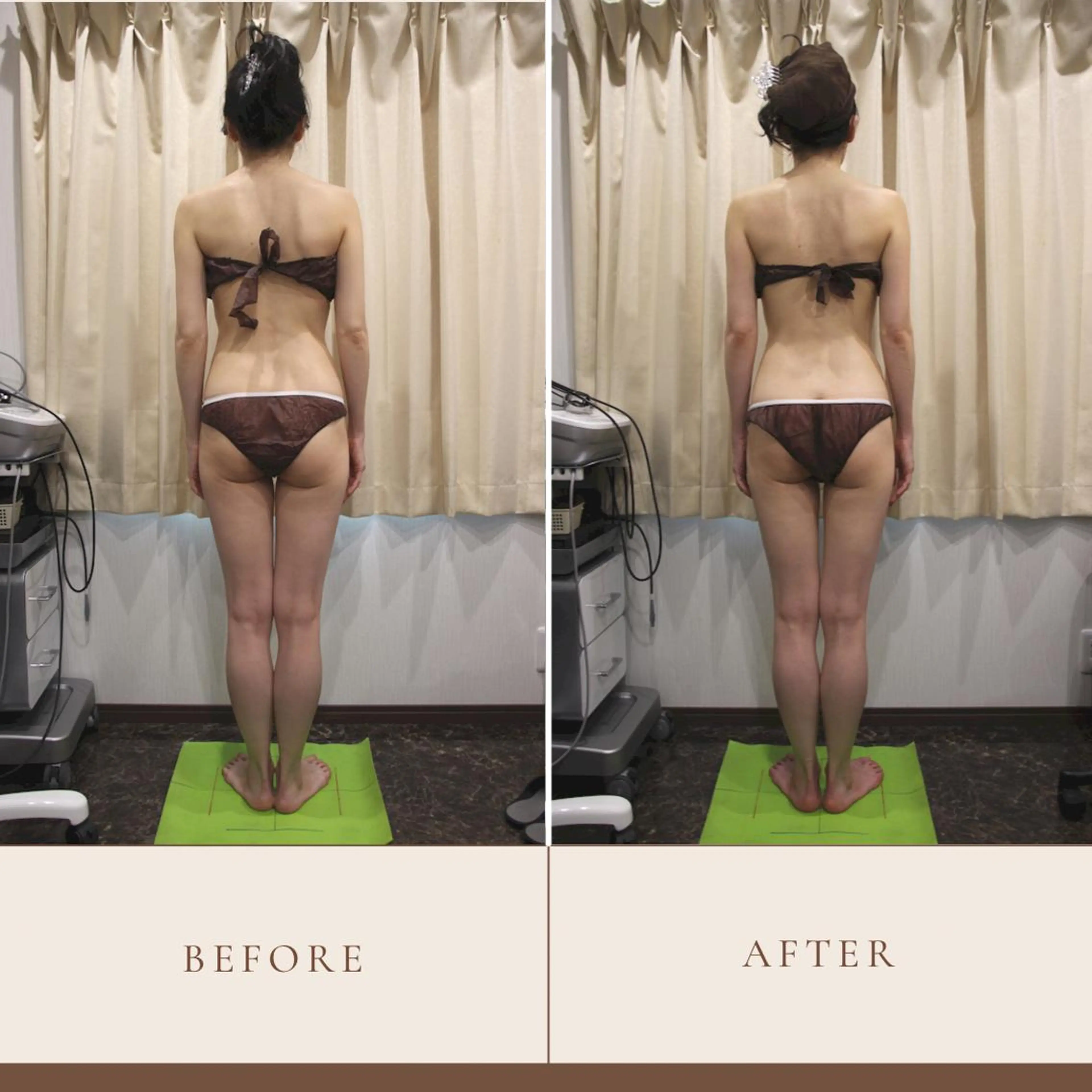 ANRIRE (アンリール)のエステ・リラクイメージ