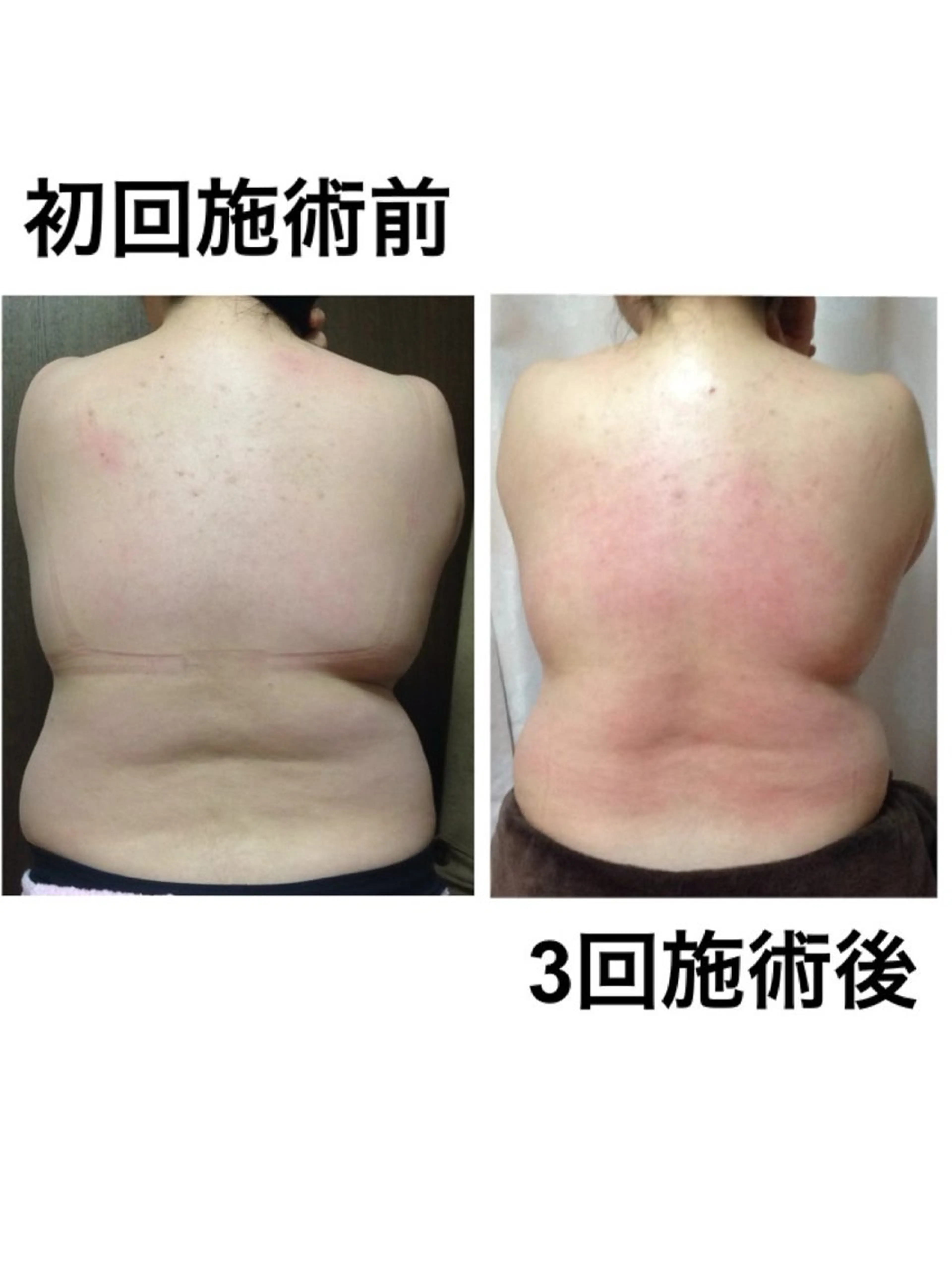 肌質を変えて すっぴん肌に✨のその他イメージ