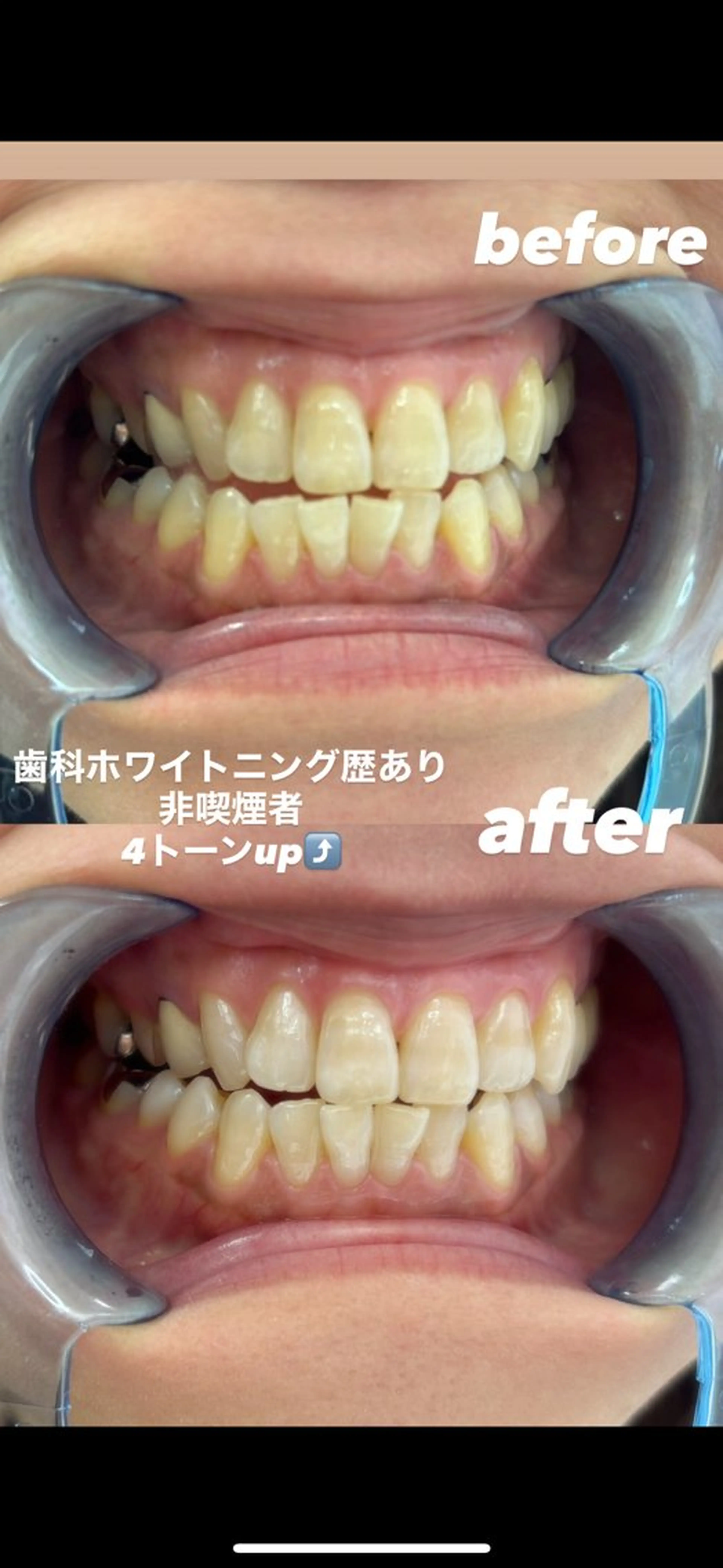 その他 𓂃𓂂ꕤ*.゚Fullcover𓂃𓂂ꕤ*.゚beauty所属・Fullcover beautyのその他イメージ