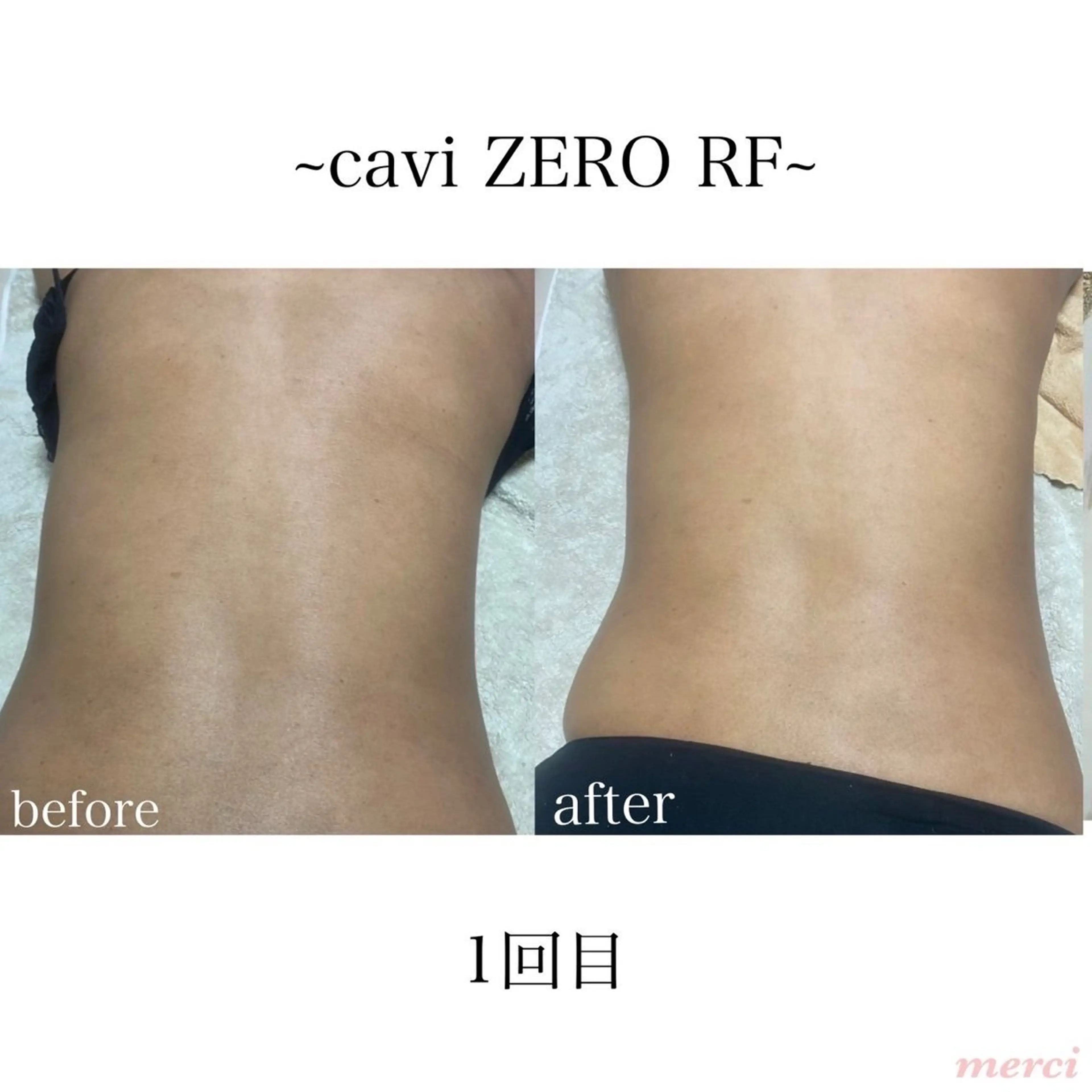 salon merci和泉のエステ・リラクイメージ