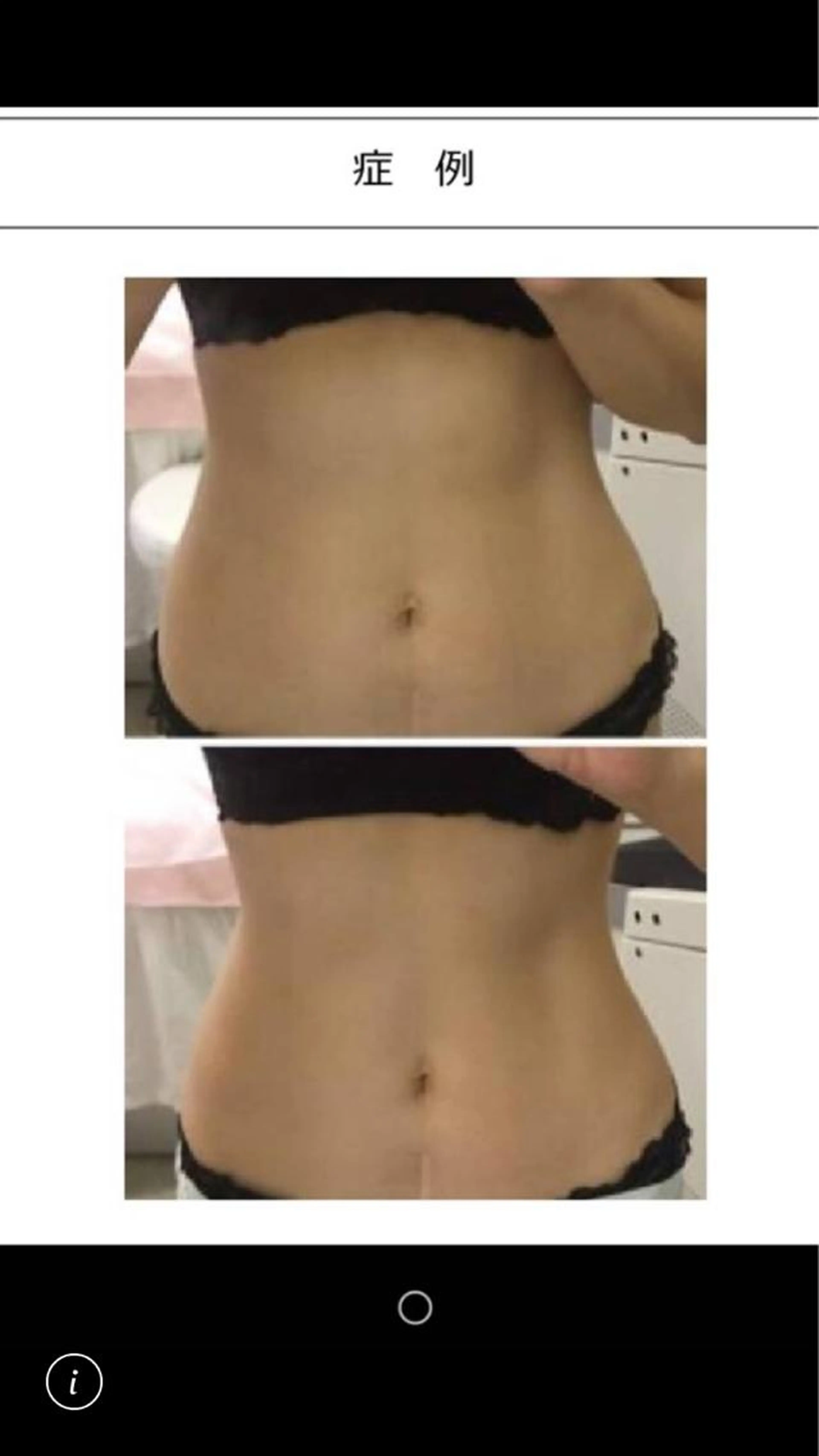 【女性の味方♪ダイエットに失敗してきた方に！】綺麗に楽してやせたい/しなやかで美しい筋肉に変えましょう♪の写真