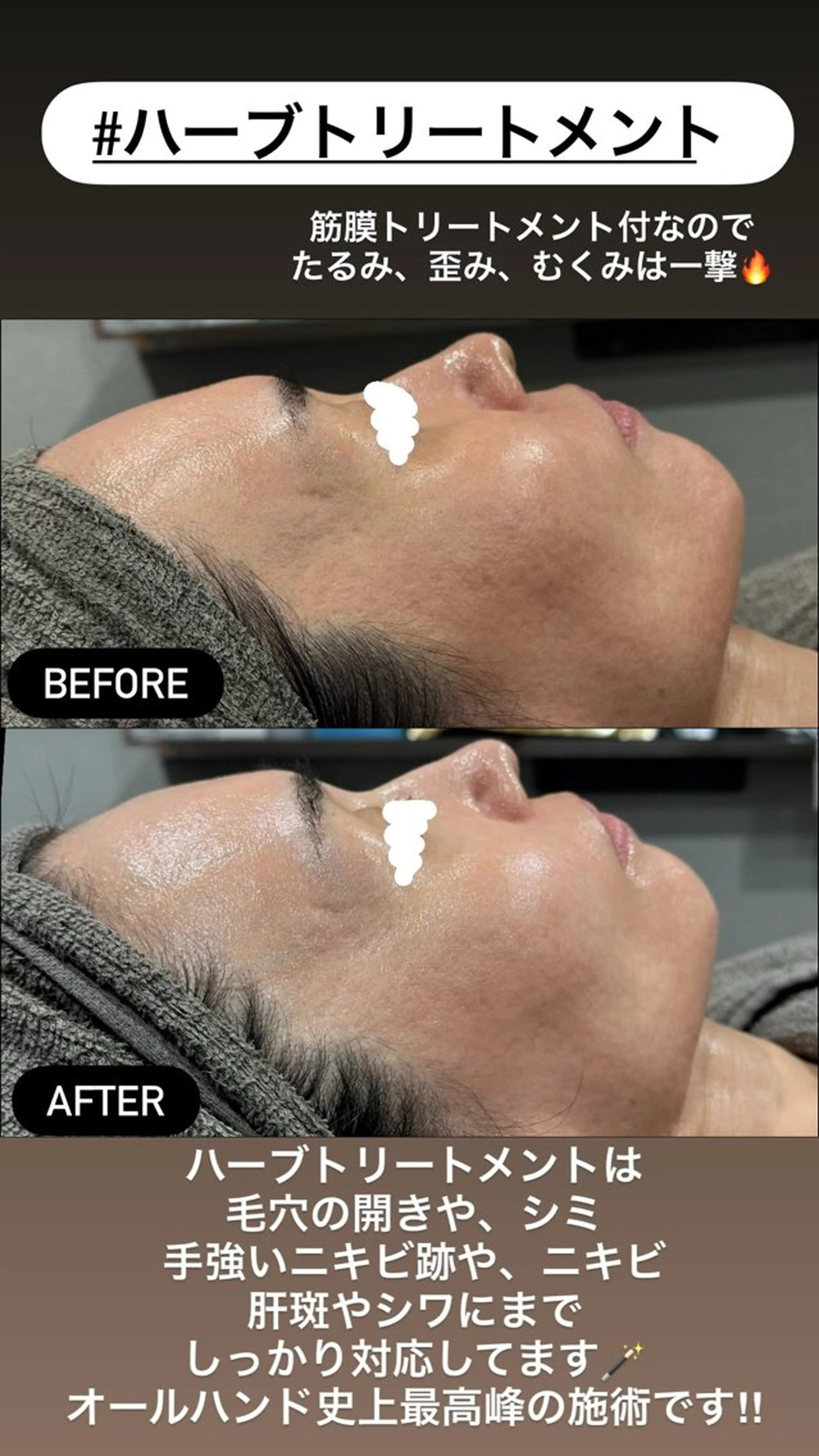 エステ LiZA エステティックサロンのエステ・リラクイメージ