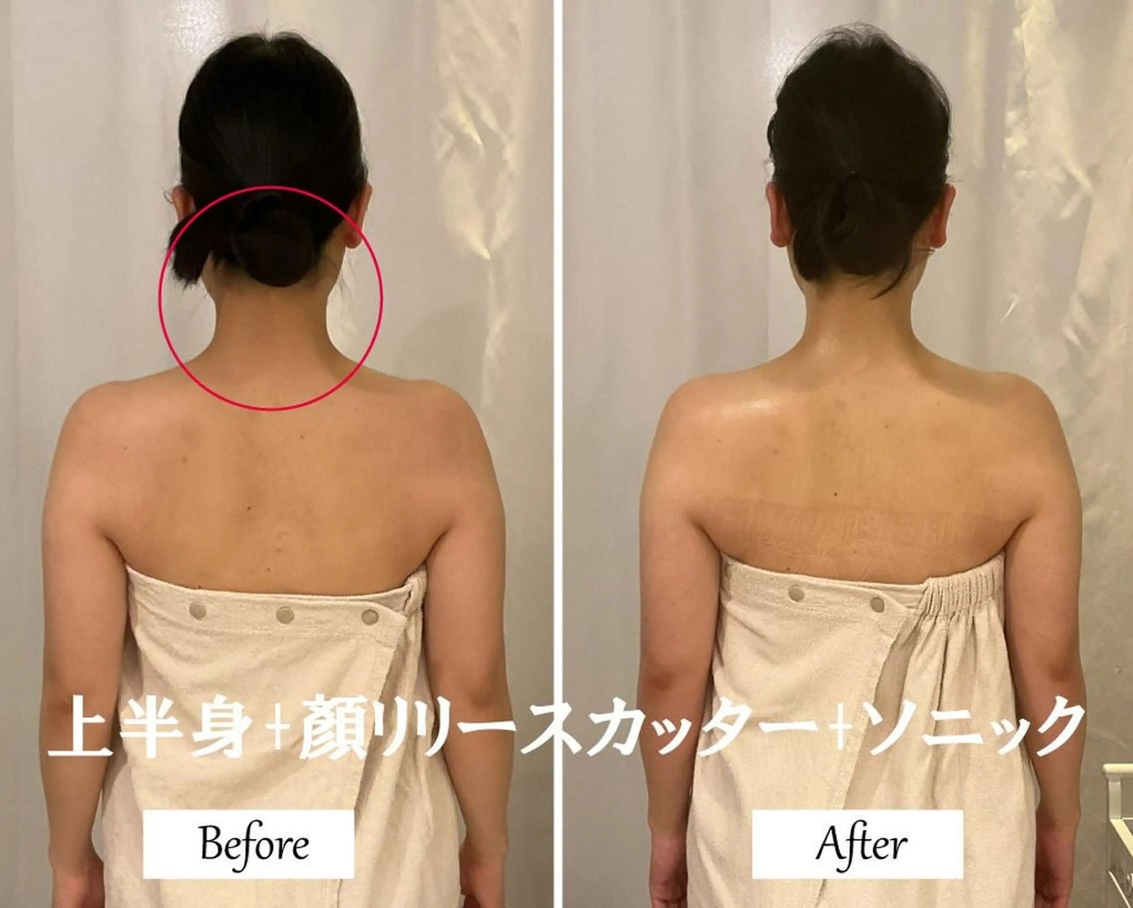 ブライダルサロン ｜Lino【堀江】のエステ・リラクイメージ