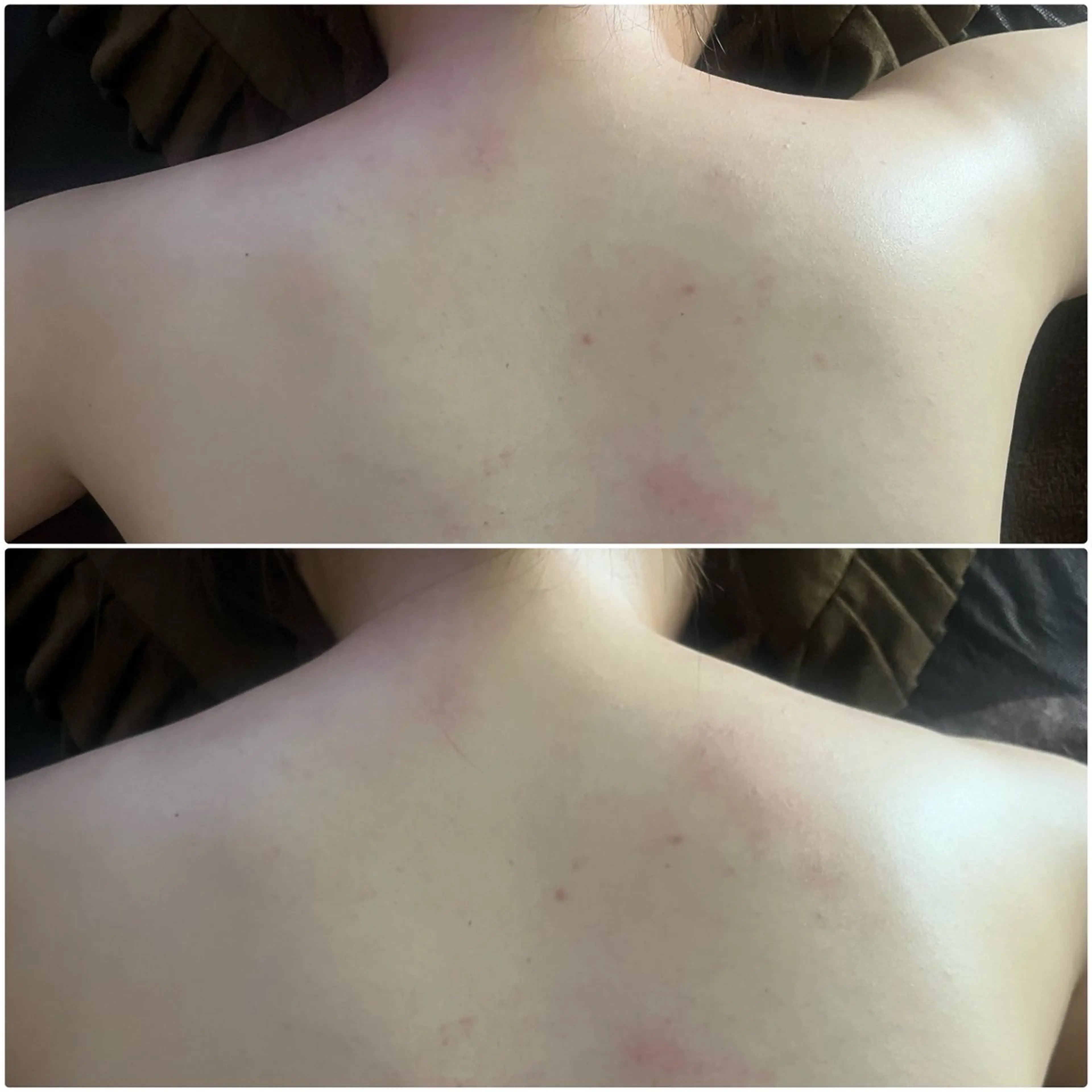 リラク アロマ･美容鍼･カッ ピング「麗」鍼灸院のエステ・リラクイメージ