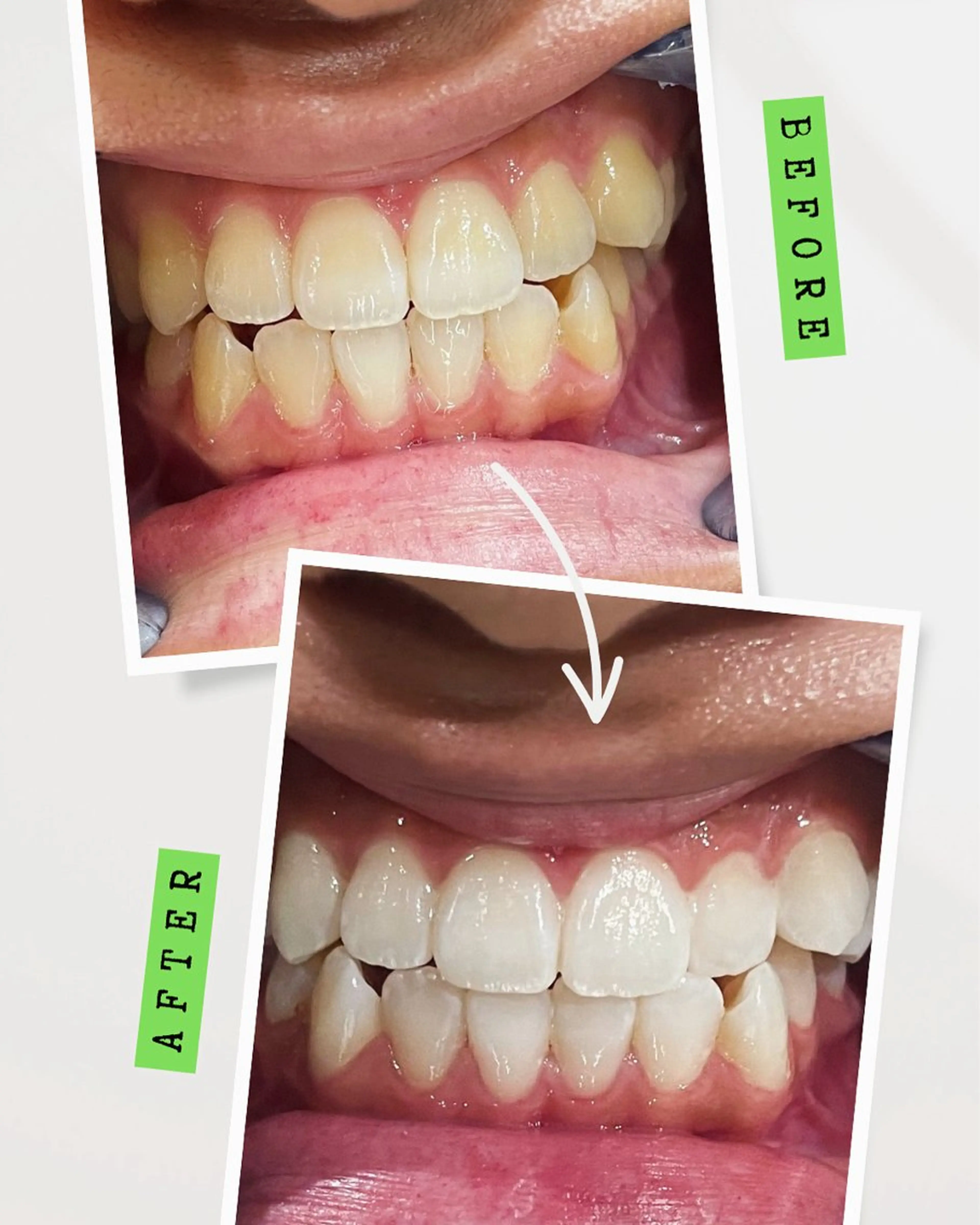 【本気で白くしたい人に絶対オススメ】通い放題プラン(月額¥11,000)の写真