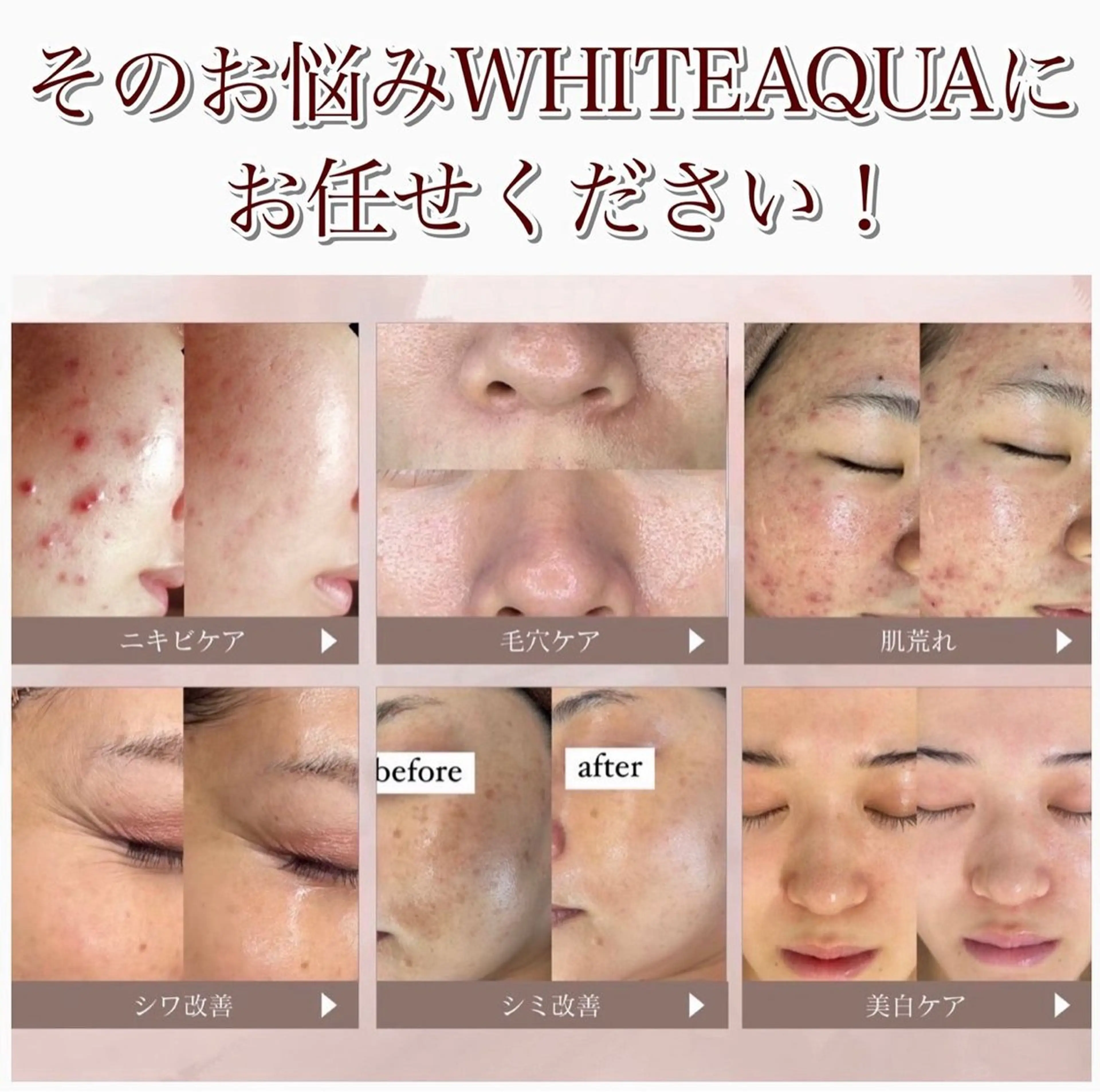 その他 WHITE AQUA 🌼柏店のエステ・リラクイメージ