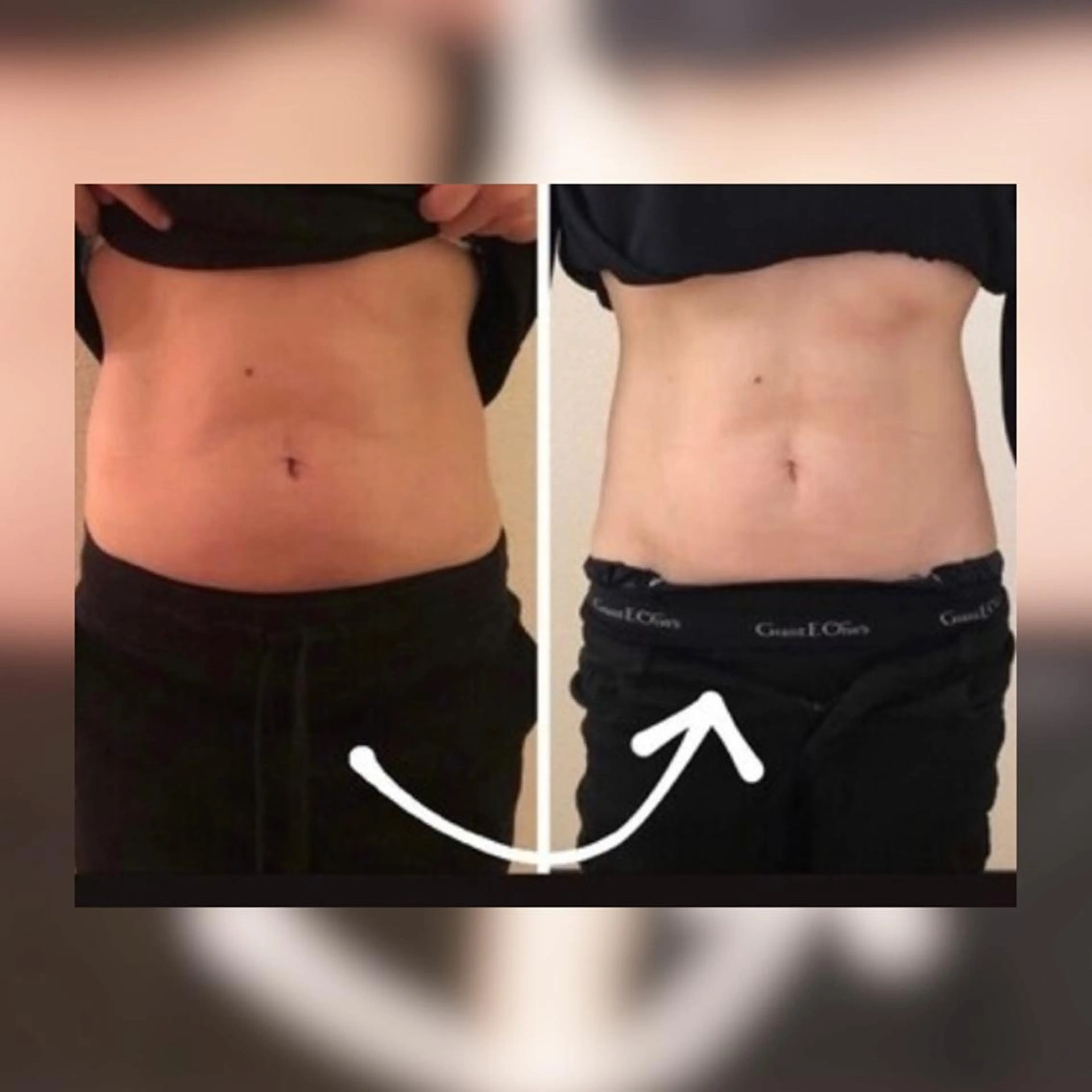 Lam..肌質改善 専門 女性専用サロンのエステ・リラクイメージ