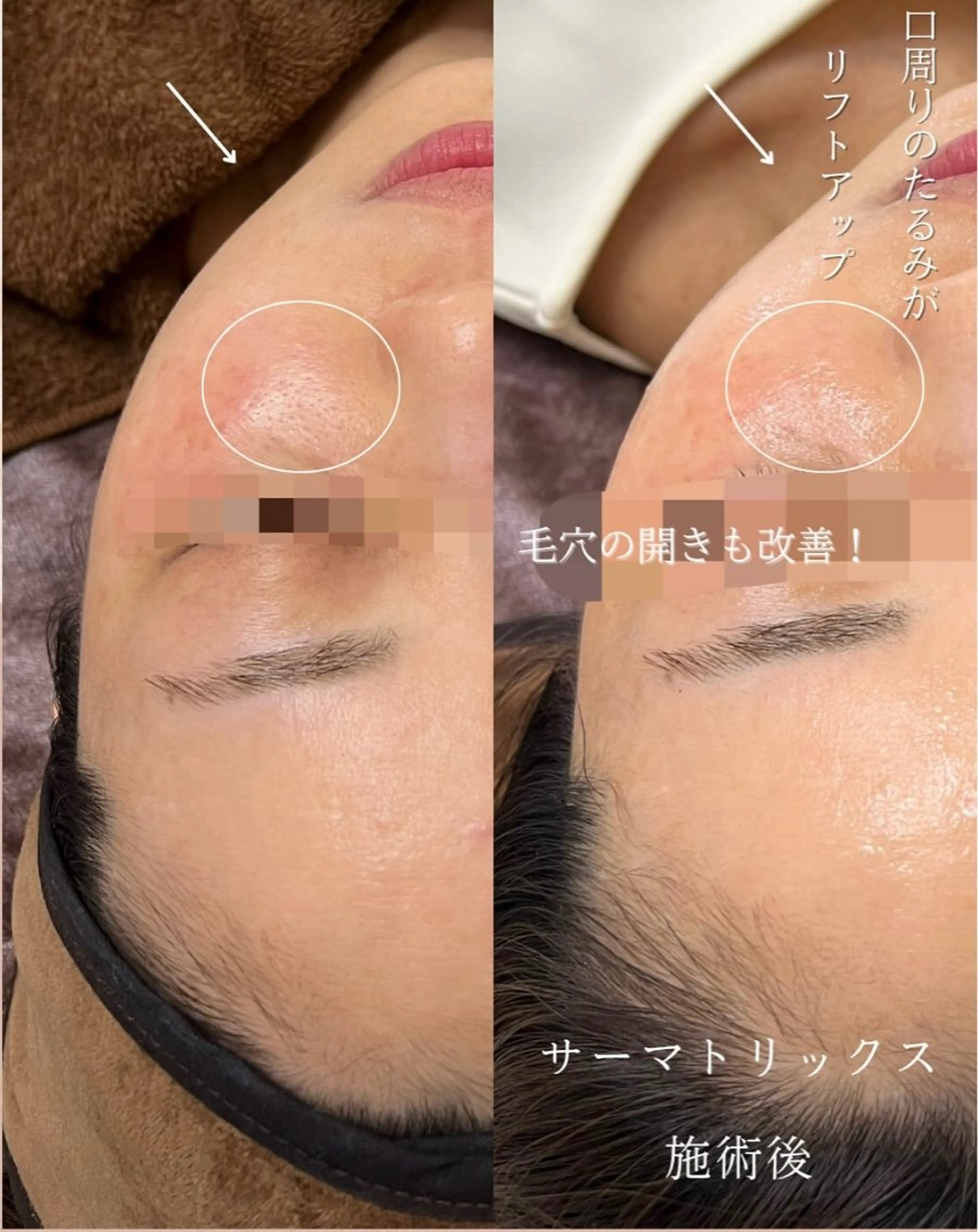 Nsが施術するサロン ナスサロ /Yuriのエステ・リラクイメージ