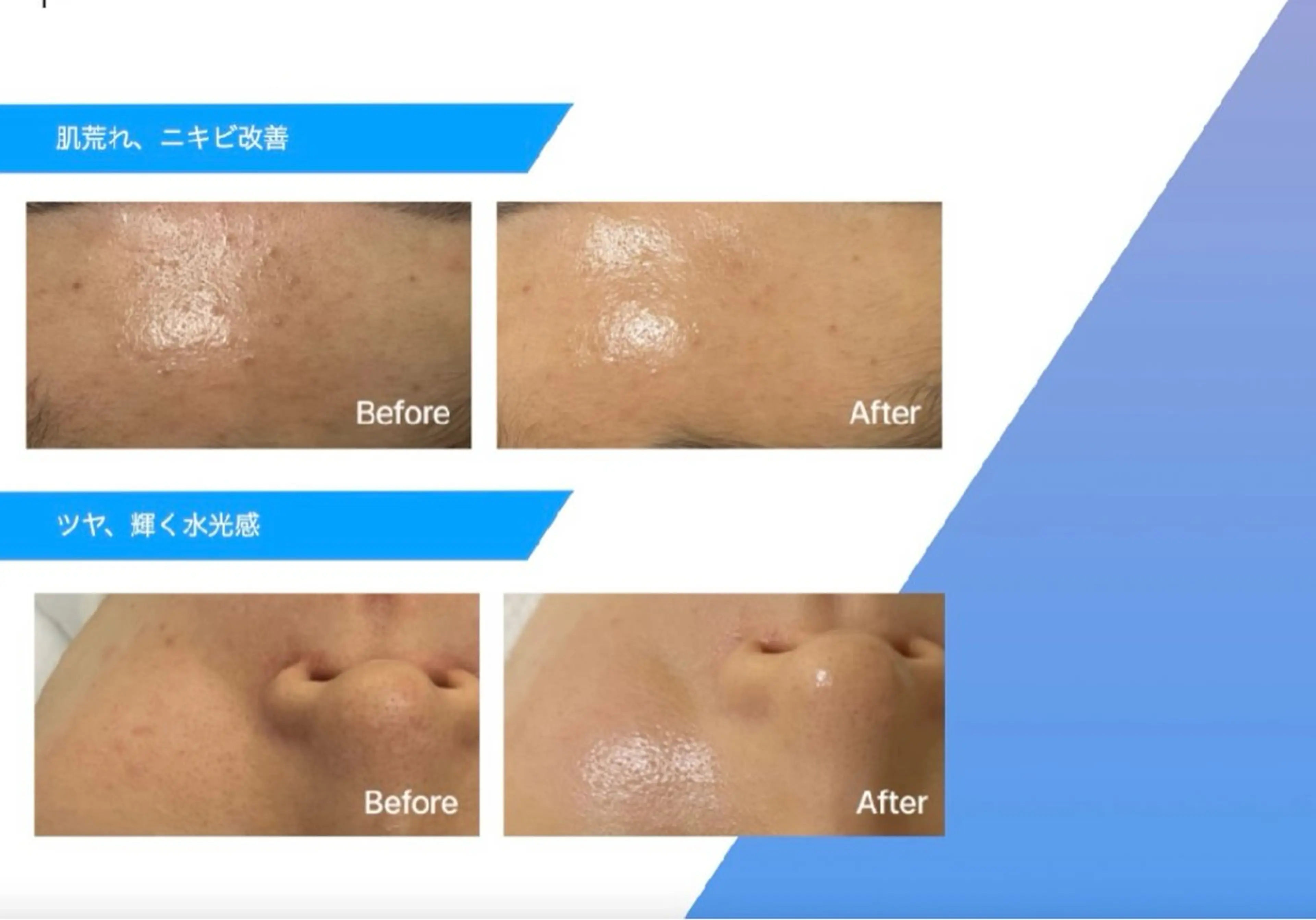 エステ レティティア【Laetitia】所属・レティティア秋葉原店 Yoshizawaのエステ・リラクイメージ