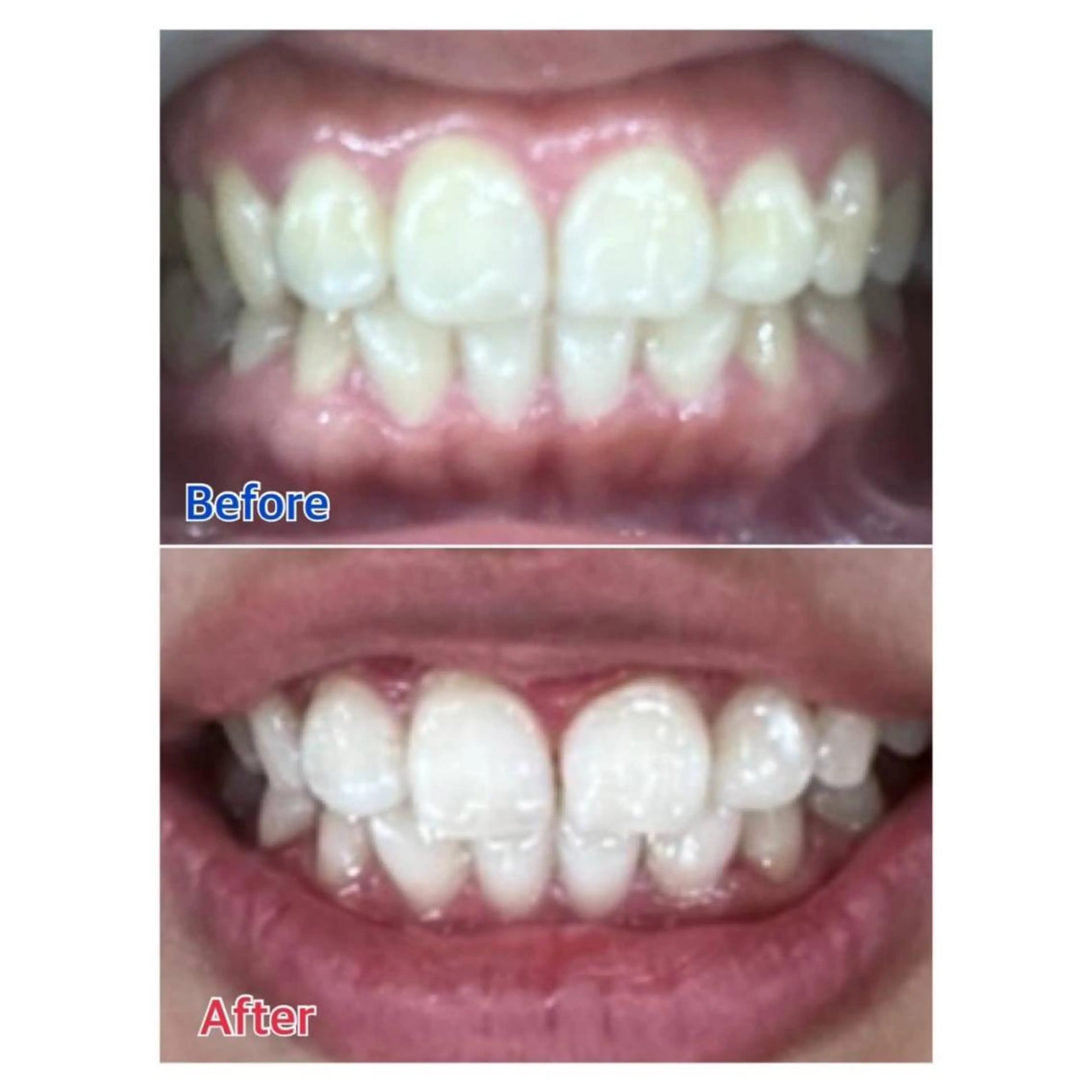 Melty 輝のその他イメージ