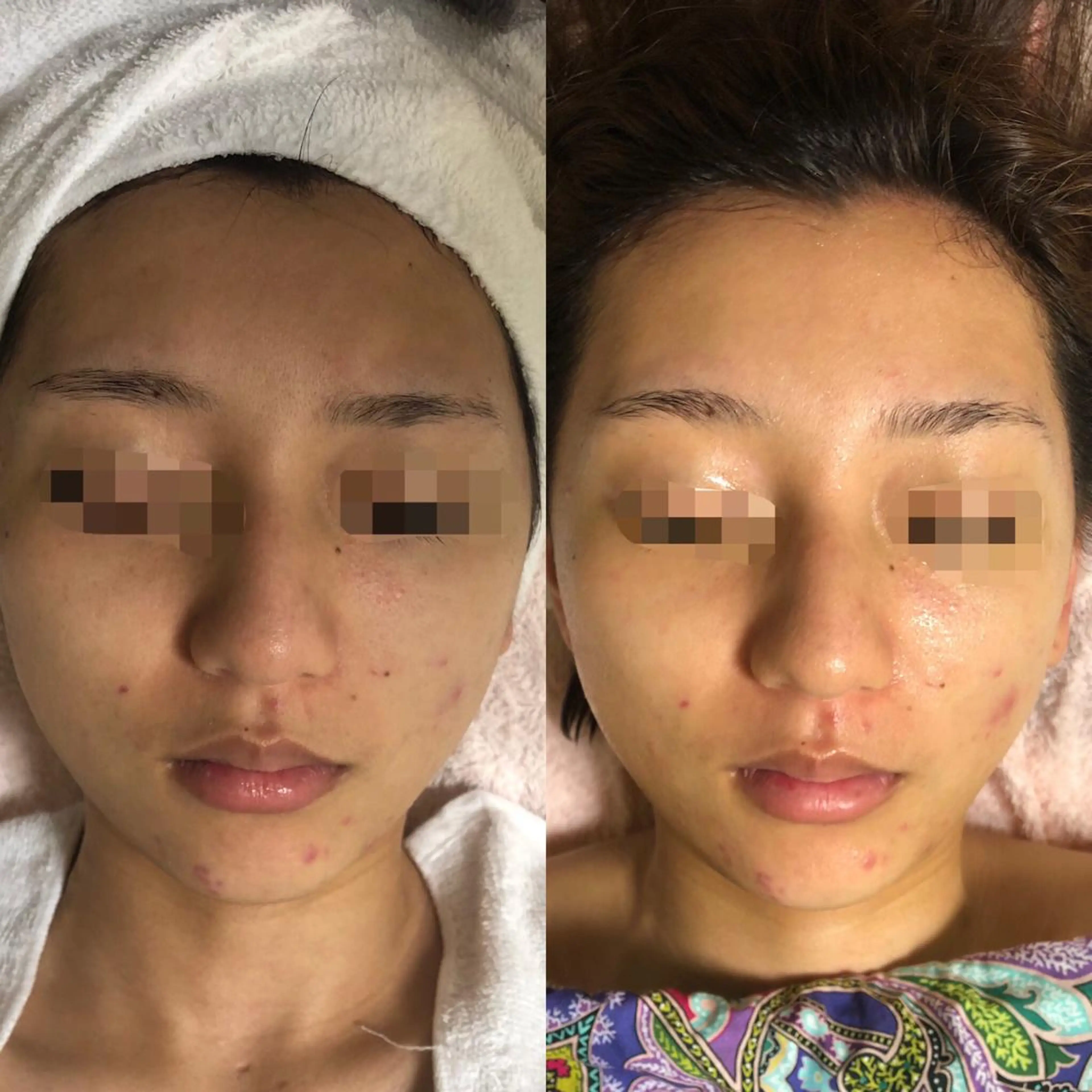 エステ エスカル ボーテのエステ・リラクイメージ