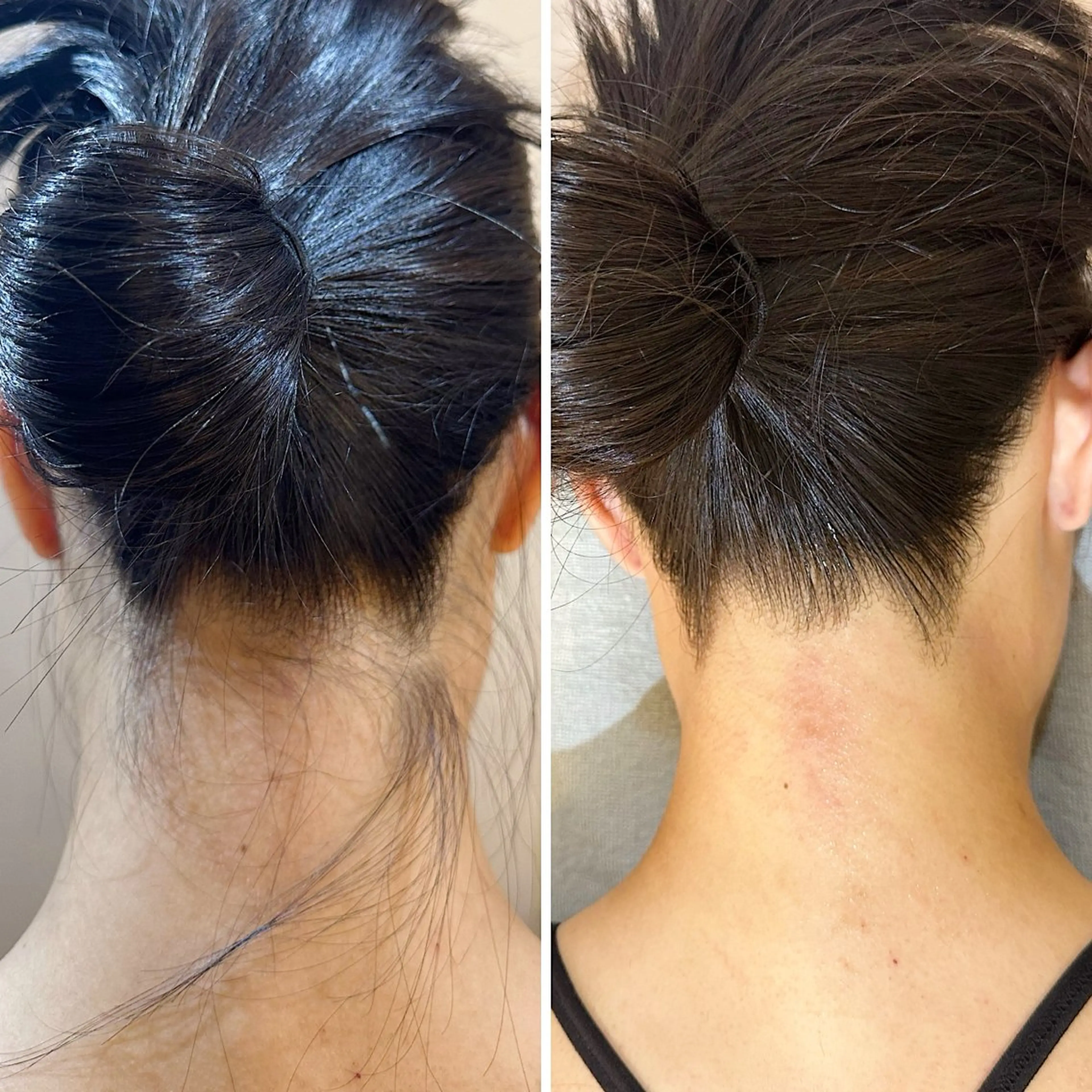 脱毛 うなじ脱毛/美肌脱毛 LABELのエステ・リラクイメージ