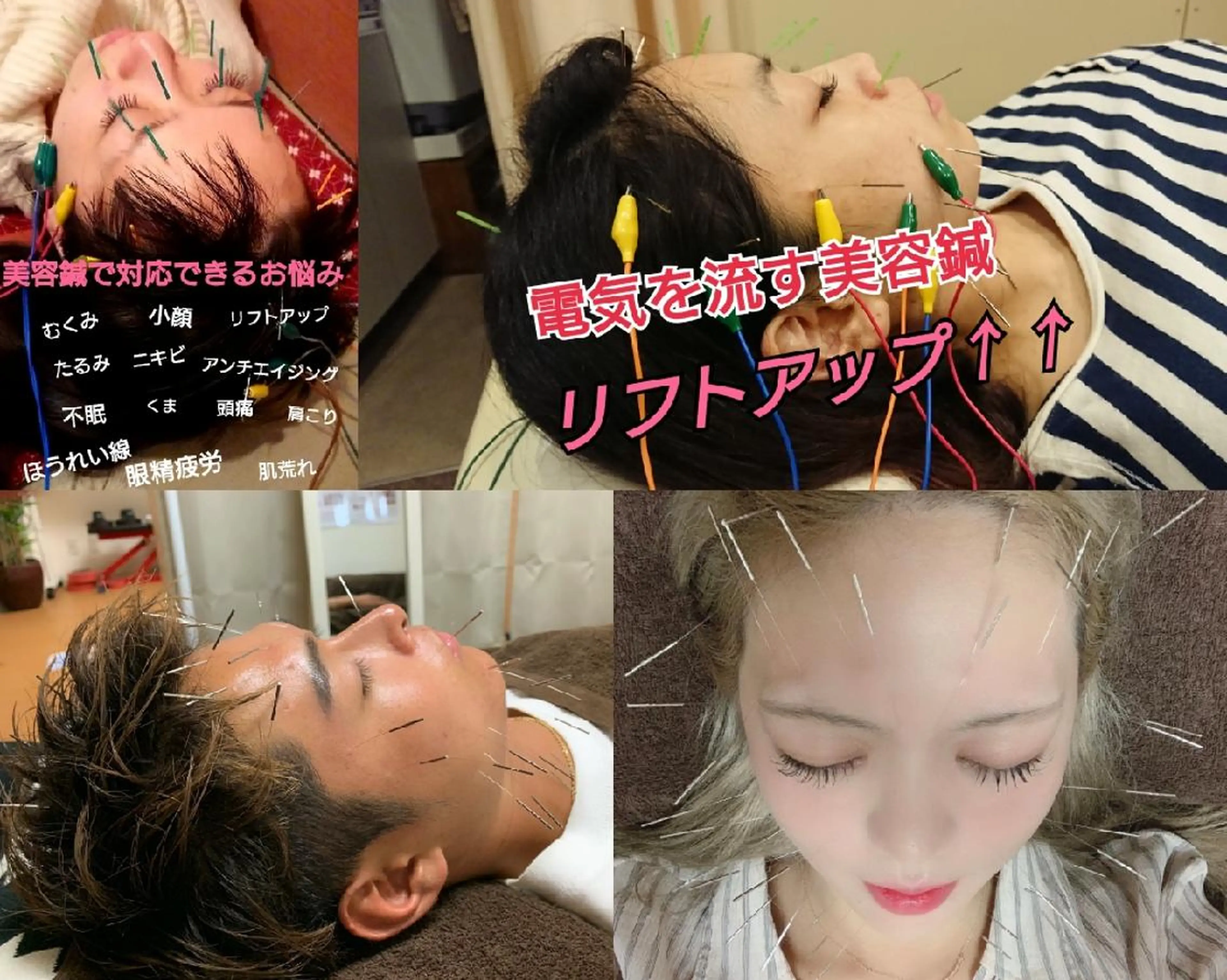 メンズ 鍼灸サロンKEYAKI所属・美容鍼灸師 皆吉 秀樹のエステ・リラクイメージ