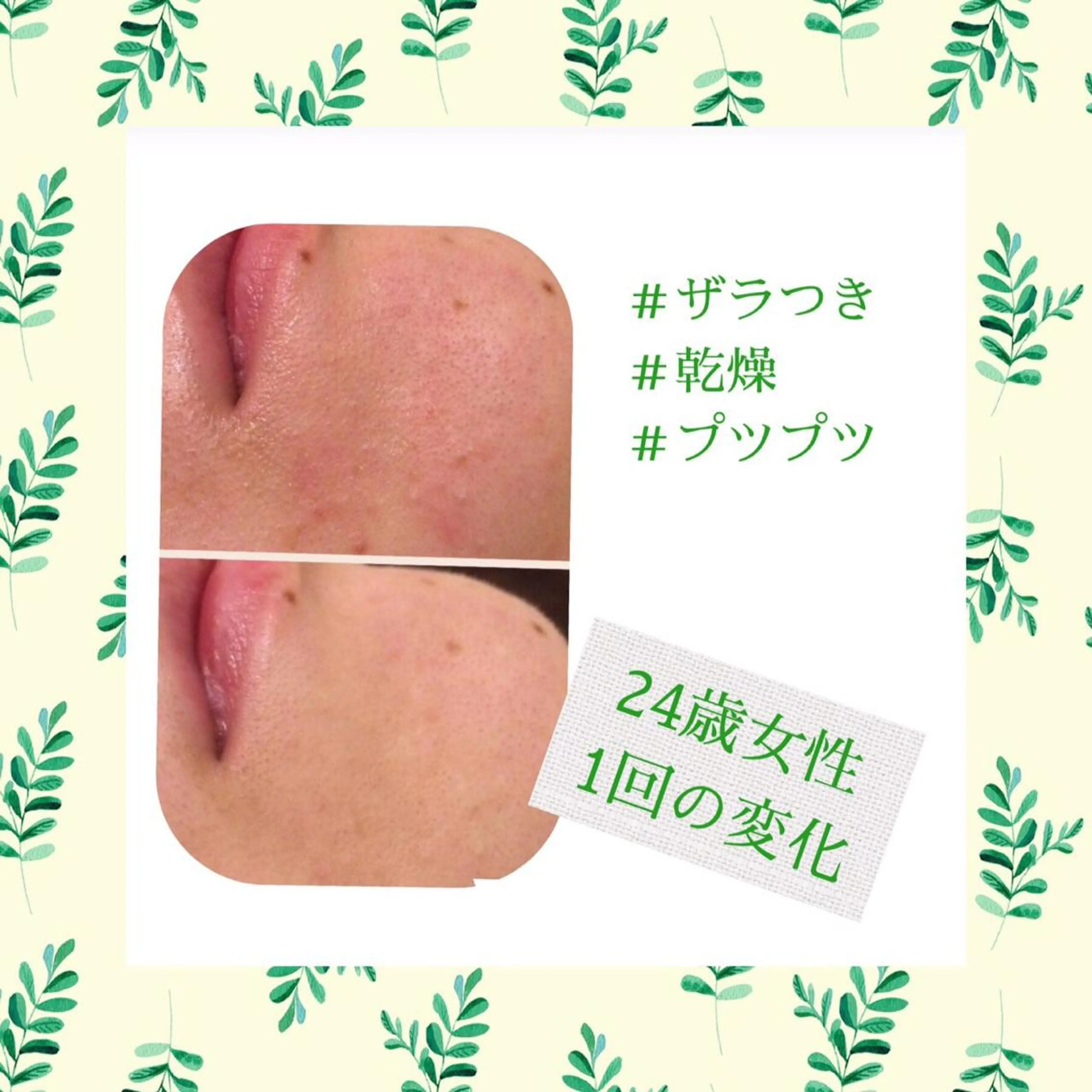 ミディアム カラー パーマ ヘアアレンジ メンズ キッズ ネイル マツエク・マツパ エステ リラク ニキビ・肌質改善専門 ♡人生が変わるサロンのエステ・リラクイメージ