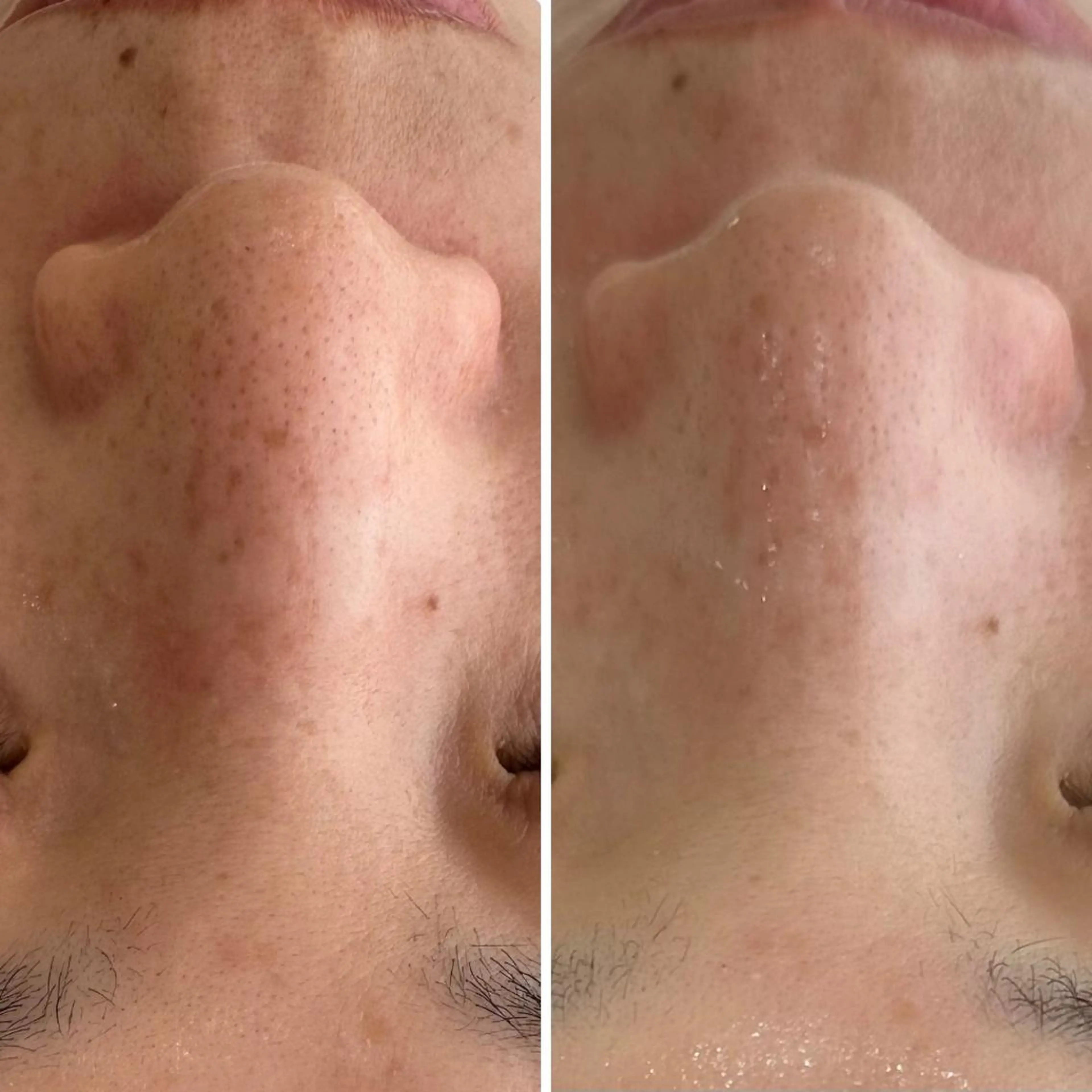 cut・the洒落夢　美肌フェイシャル所属・西本 裕子のエステ・リラクイメージ