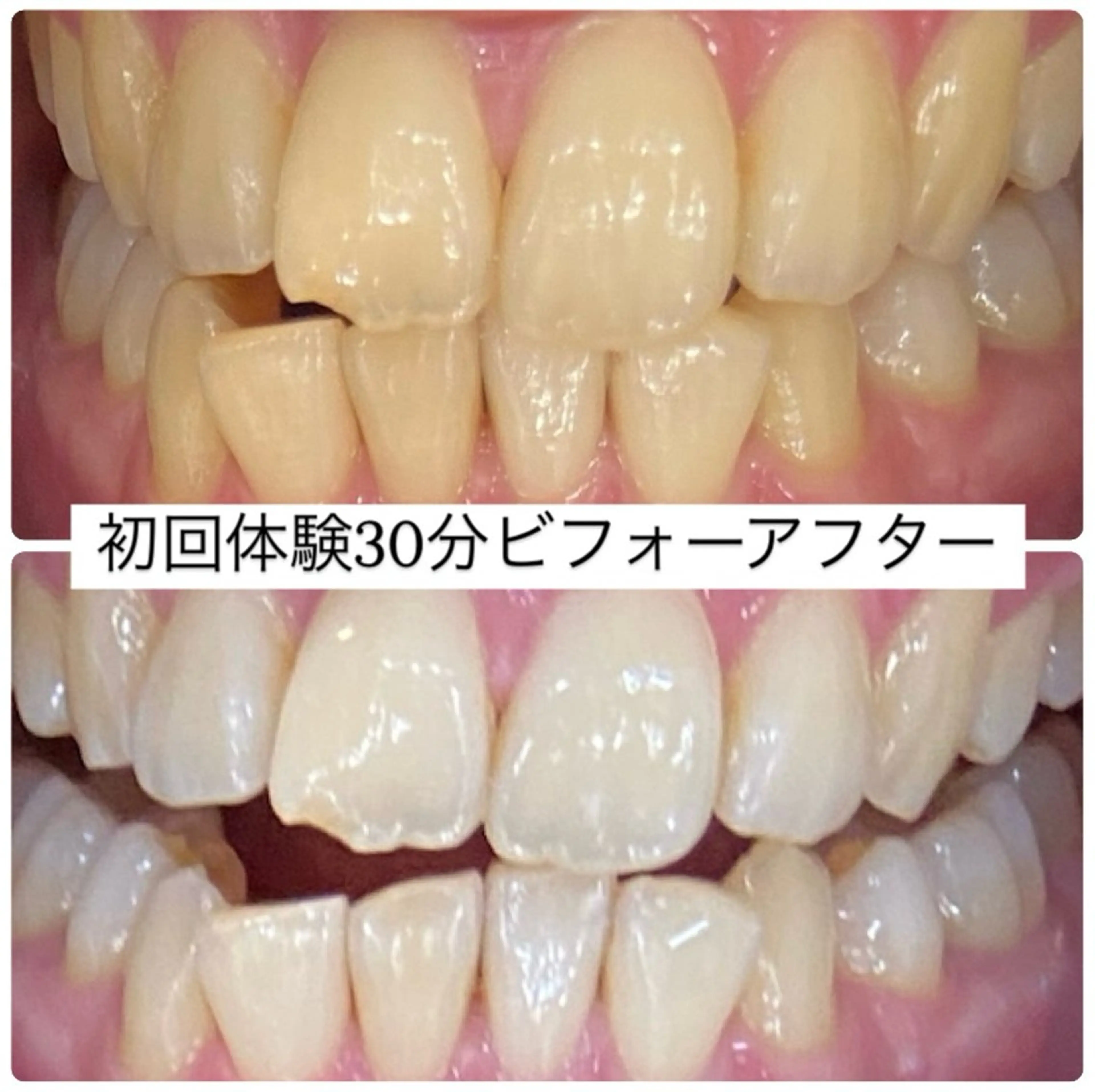 ホワイトニングルーム 横浜店のその他イメージ