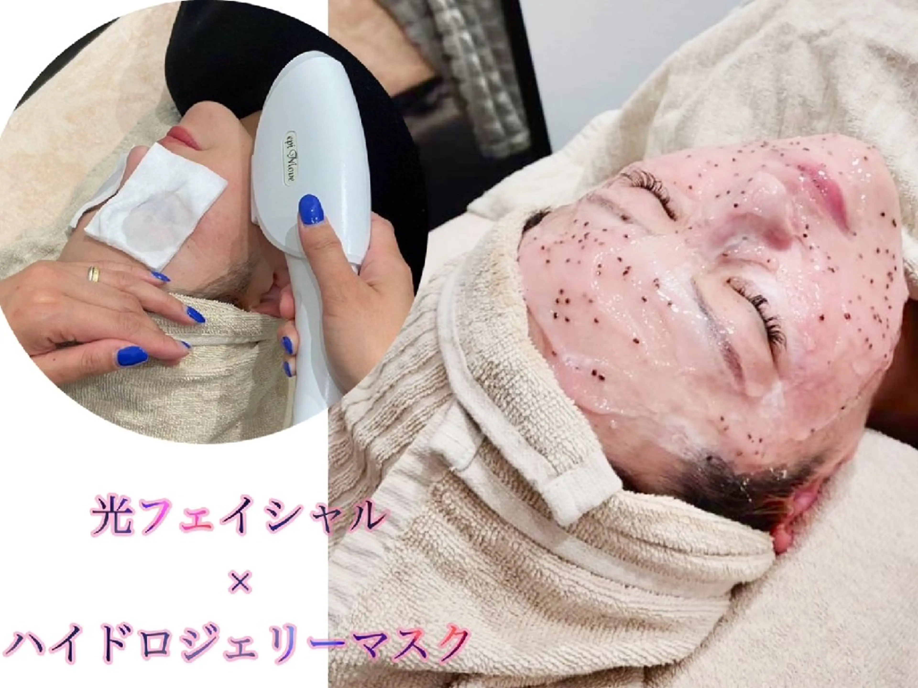 光フェイシャル＋ハイドロジェリーマスクの写真
