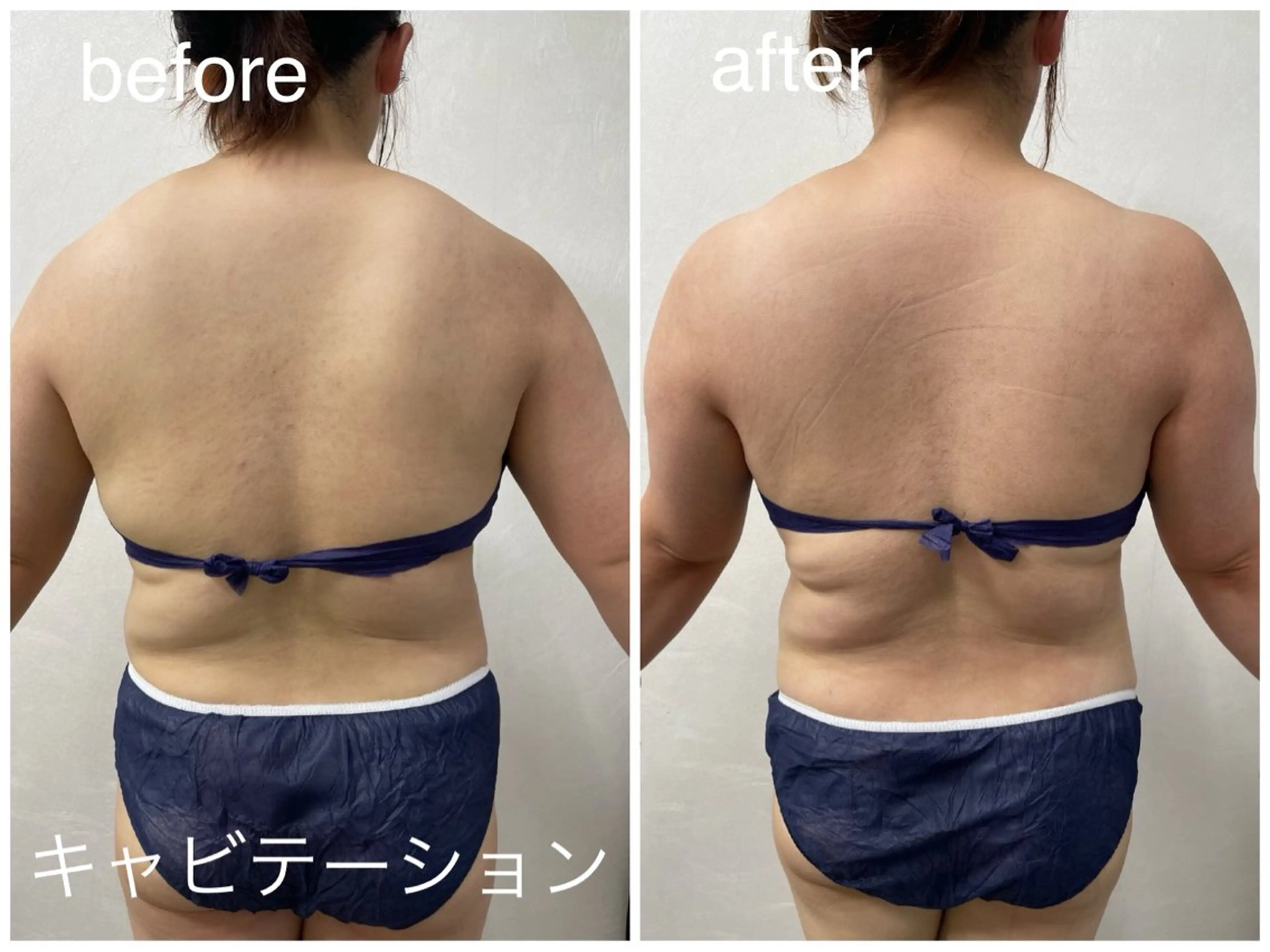 Reid-月詠-所属・Reid -月詠-のエステ・リラクイメージ