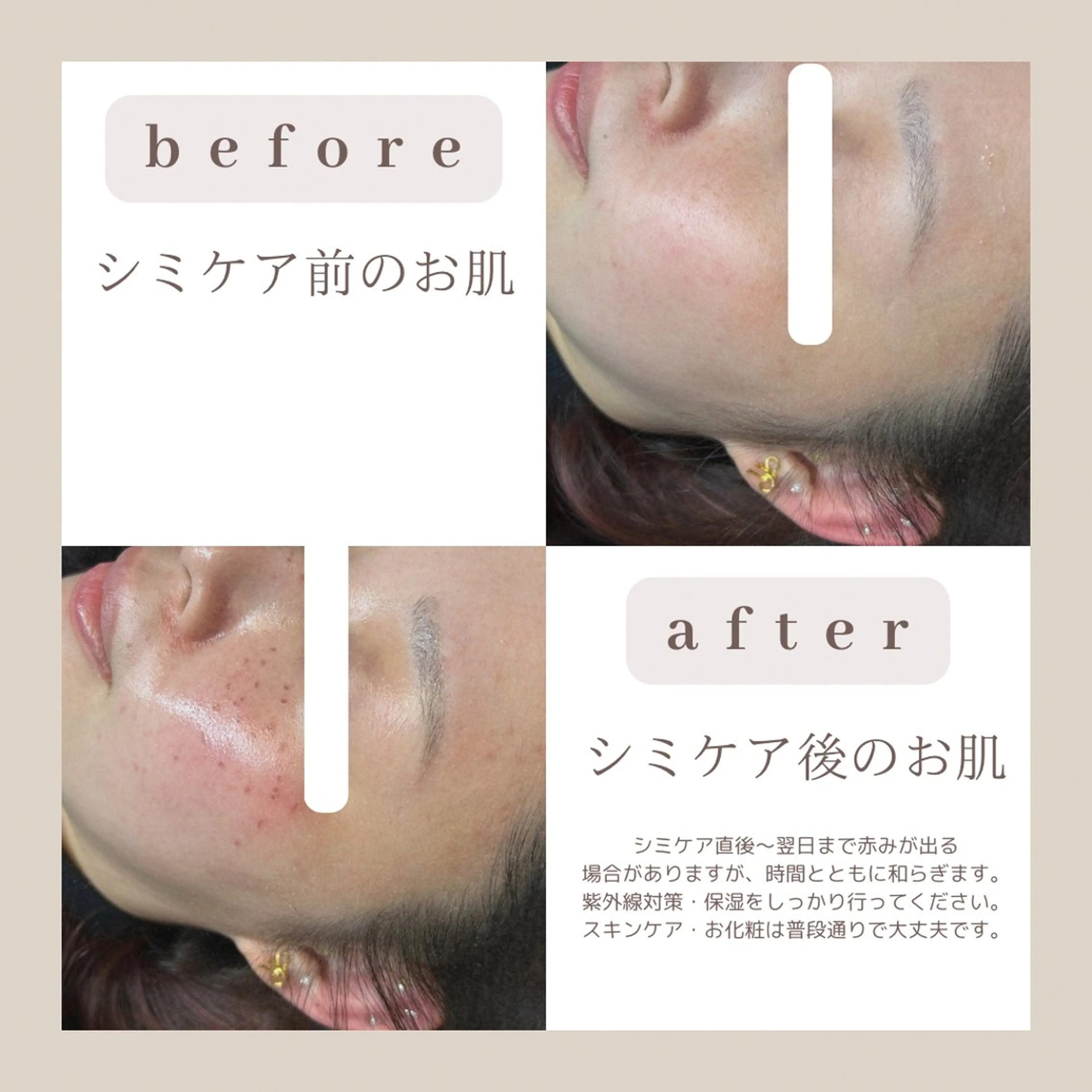 エステ emiluka beautyのエステ・リラクイメージ