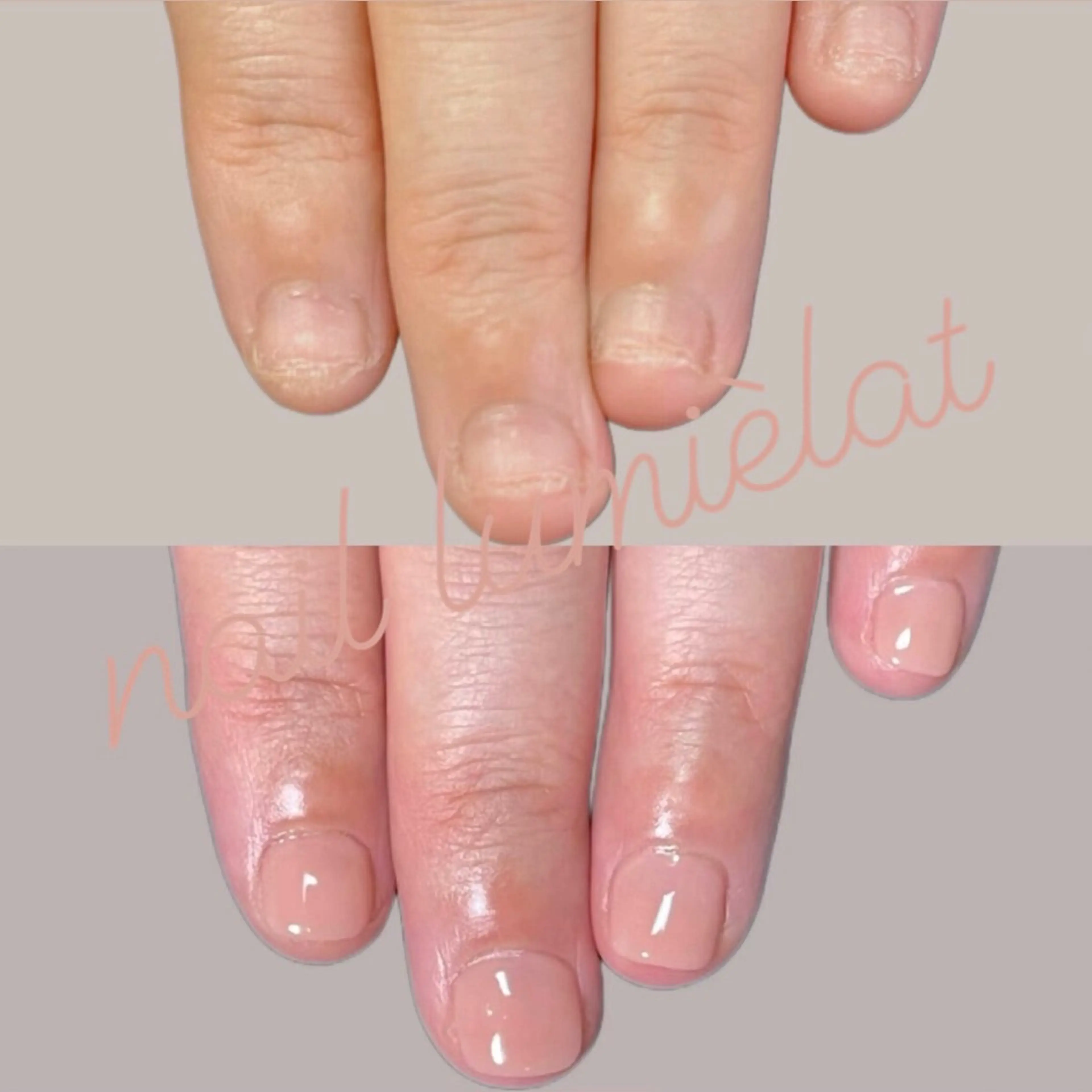 🍀毎週土曜日限定🍀 迷ってるなら体験してみてネイルしながら深爪育成【初回体験・オフ無し】無料で好きなカラー選べる🩷の写真