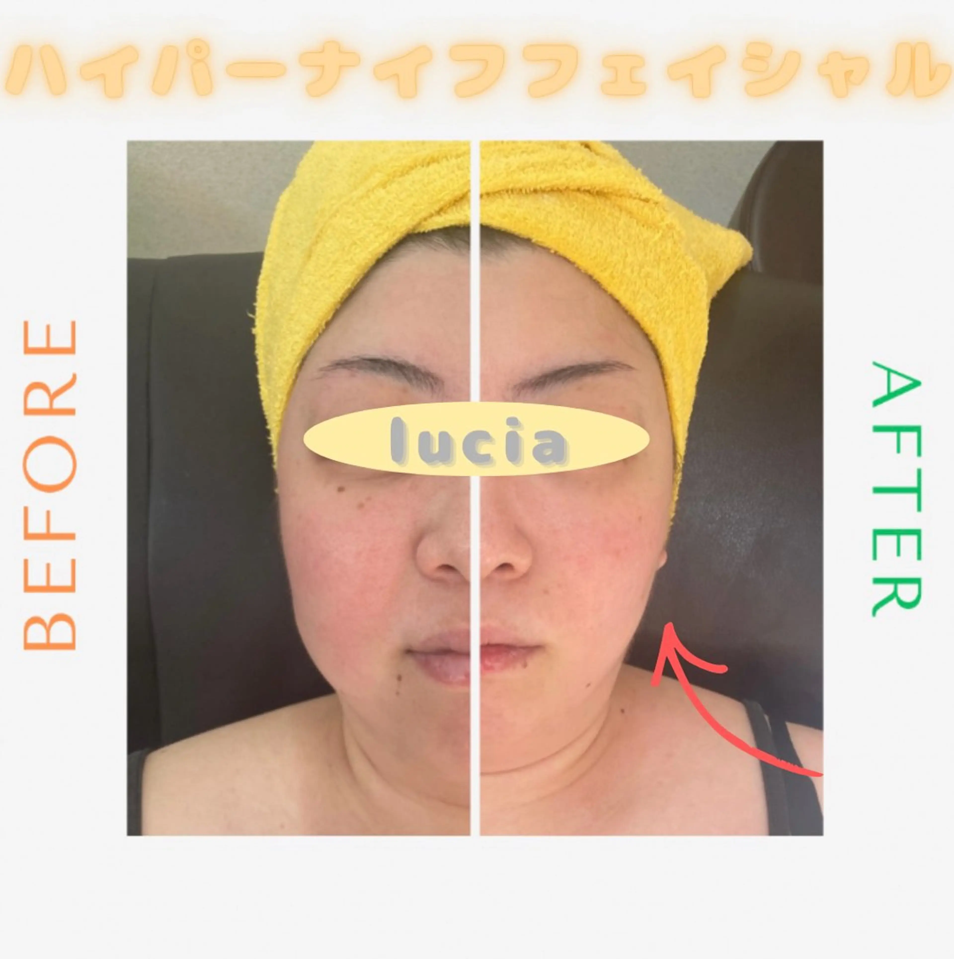 lucia  豊明 肌管理のエステ・リラクイメージ