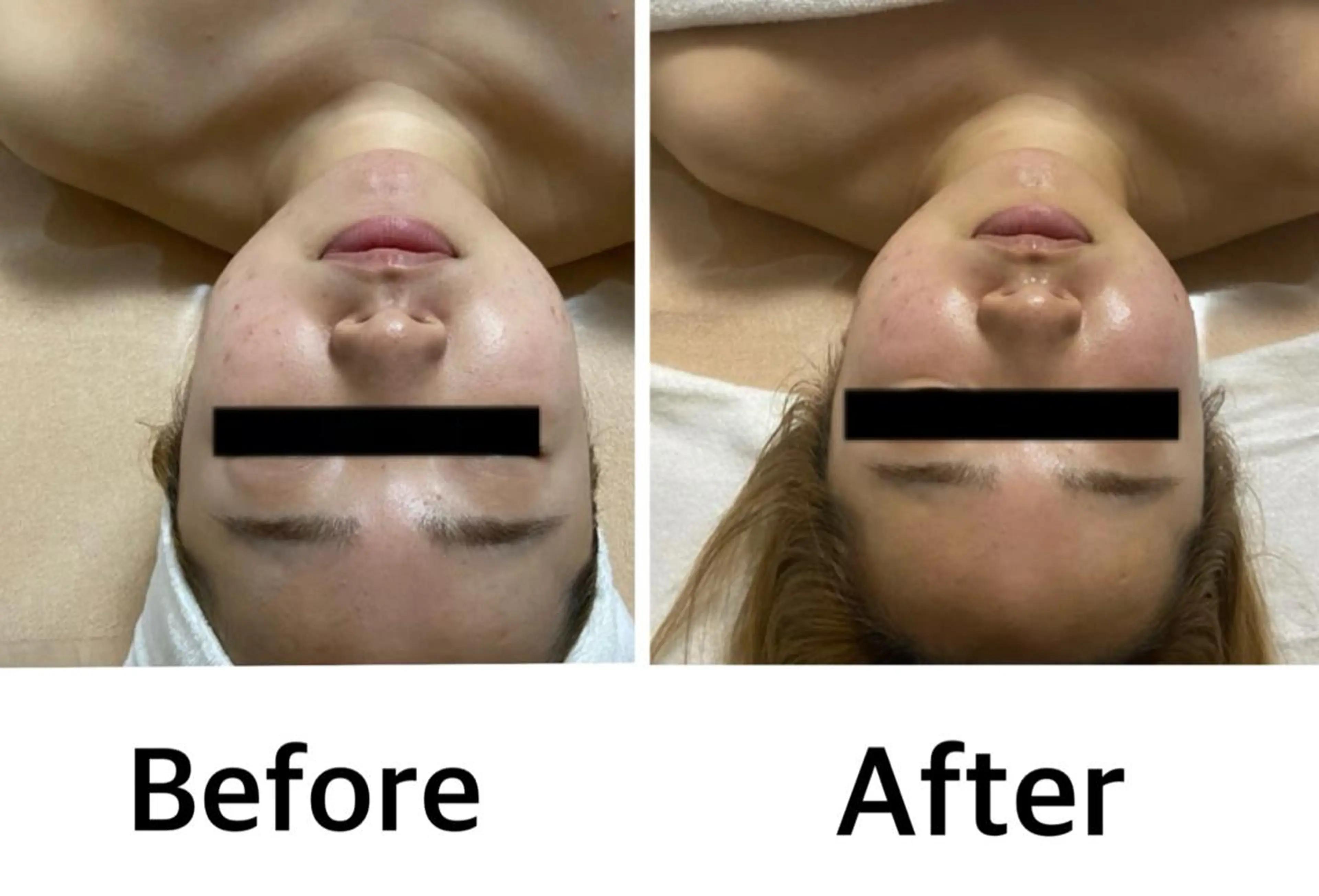 大人気！顔も体もスッキリ♪小顔コルギ60分＋ボディーオイルリンパマッサージ上半身or足30分＋パック付き（計90分）の写真