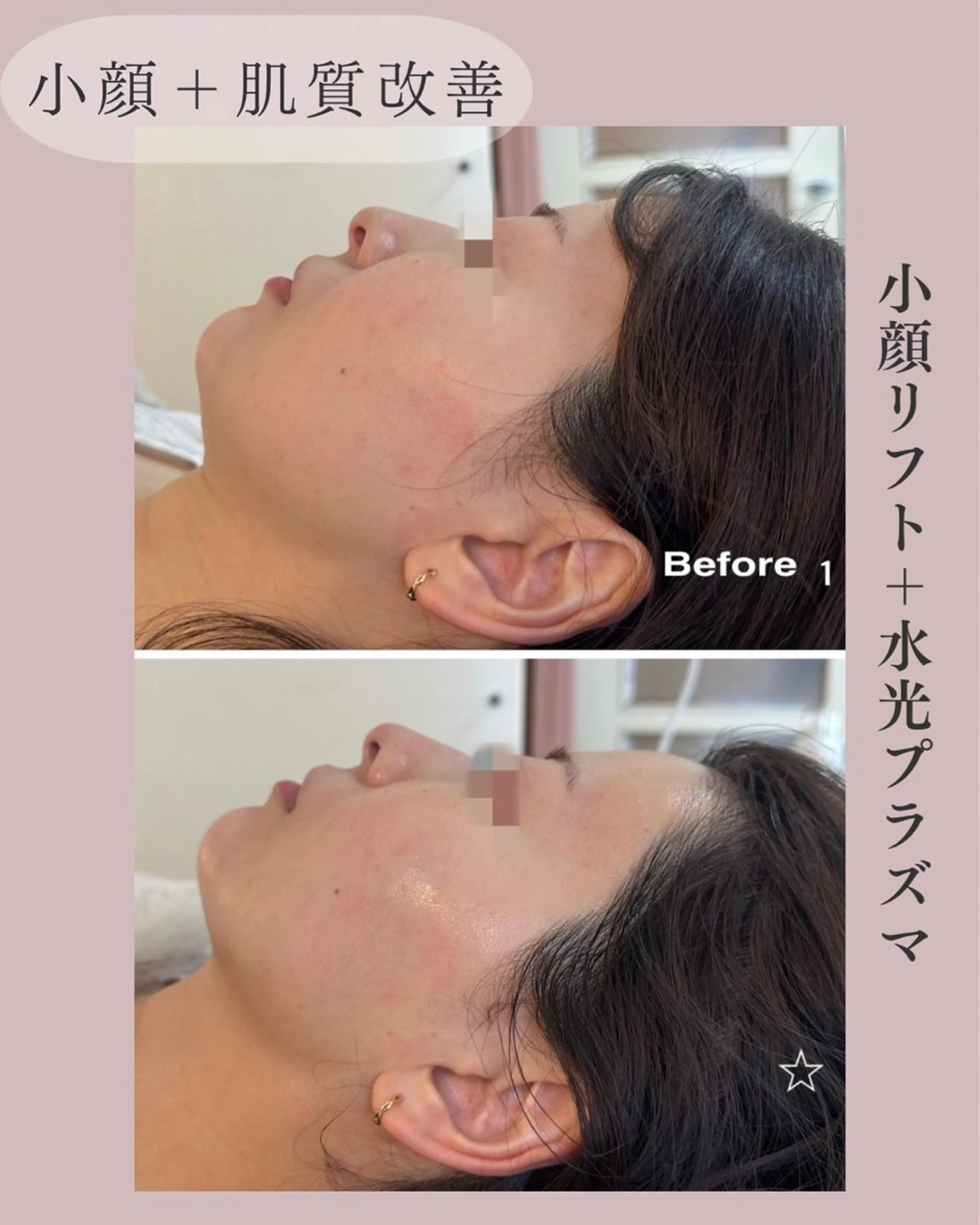 小顔＆肌質改善 NICORIのエステ・リラクイメージ