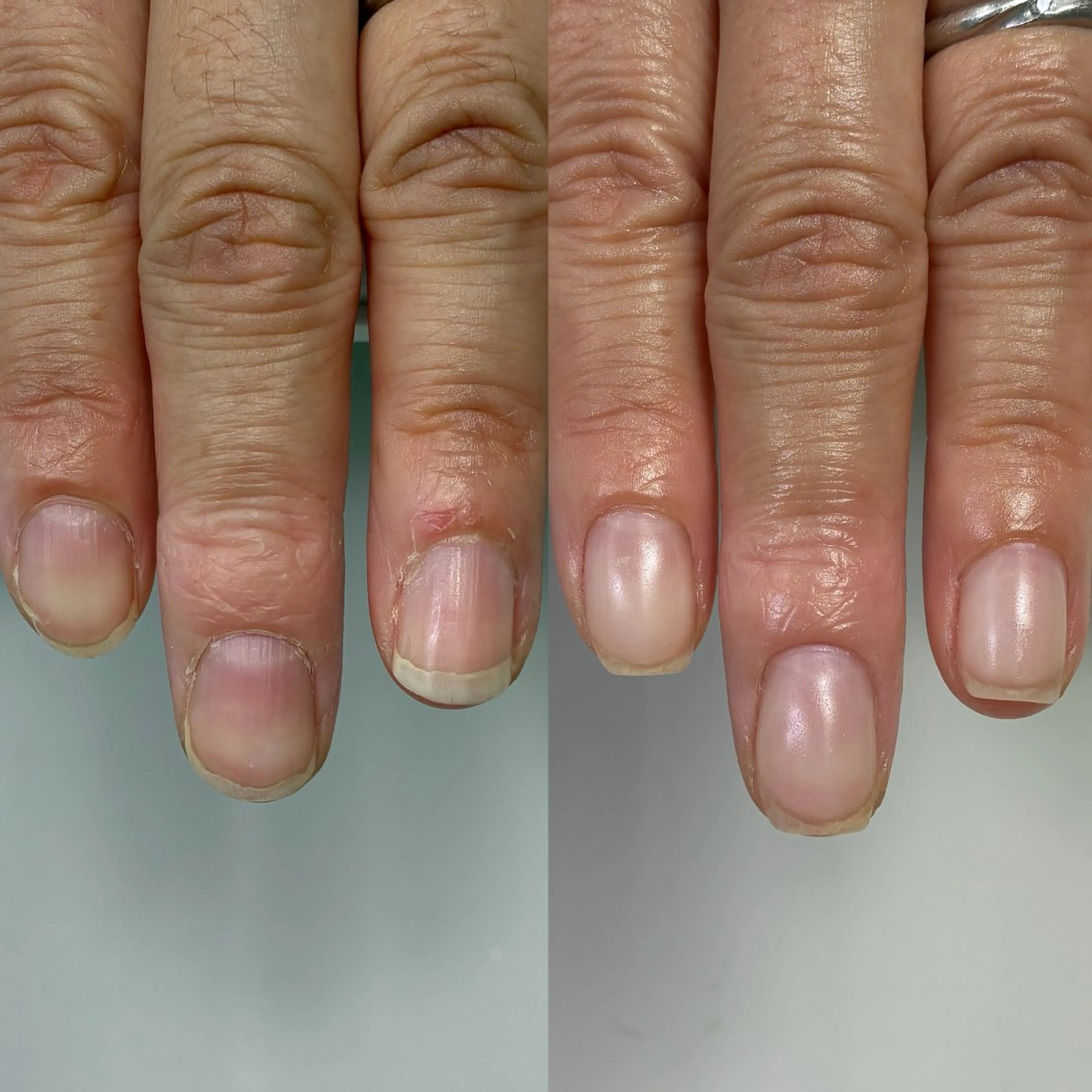 ネイル ハンドネイル ハンドケア 広島市南区(広島県) /深爪/自爪育成のネイルデザイン