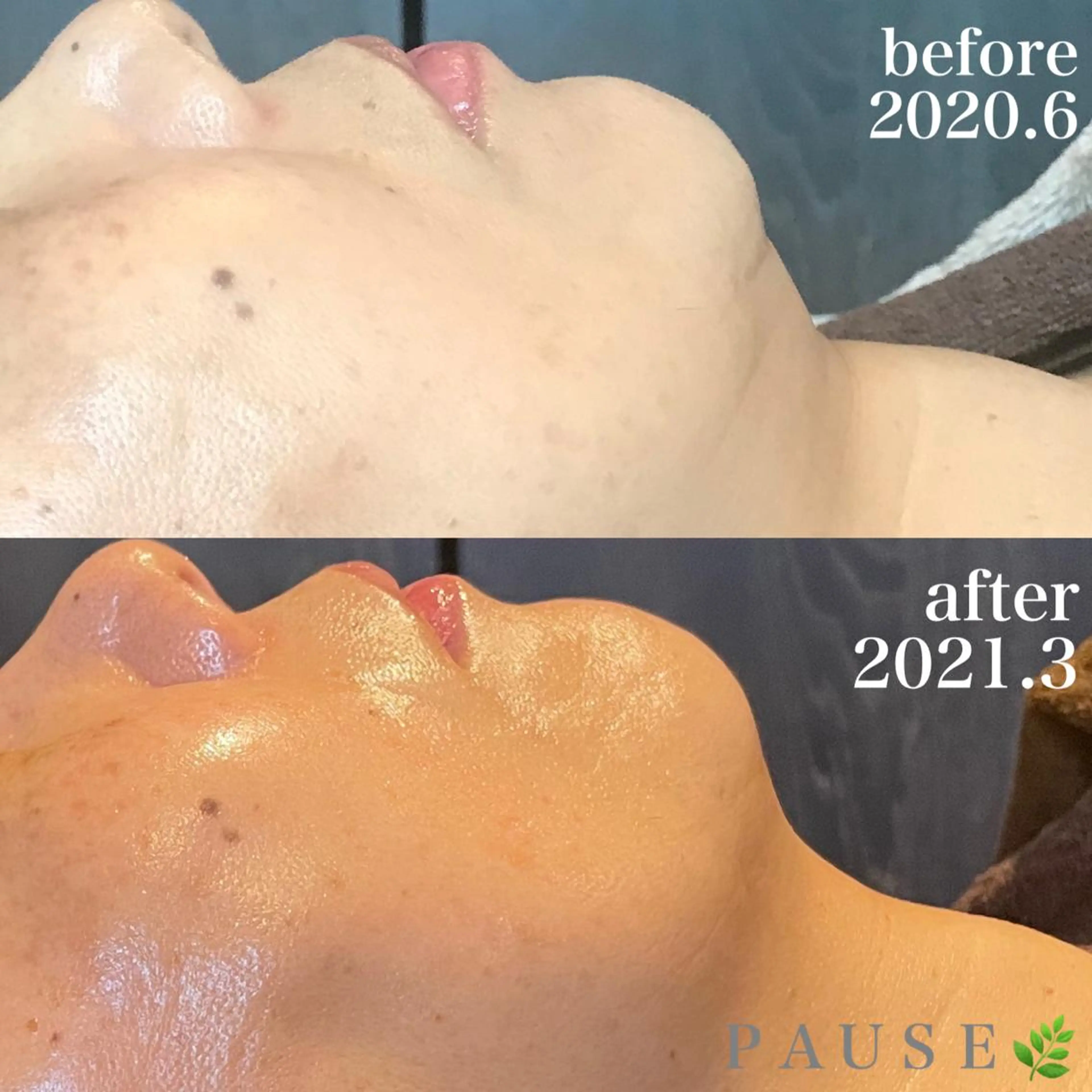 エステ 浜野 恵美のエステ・リラクイメージ