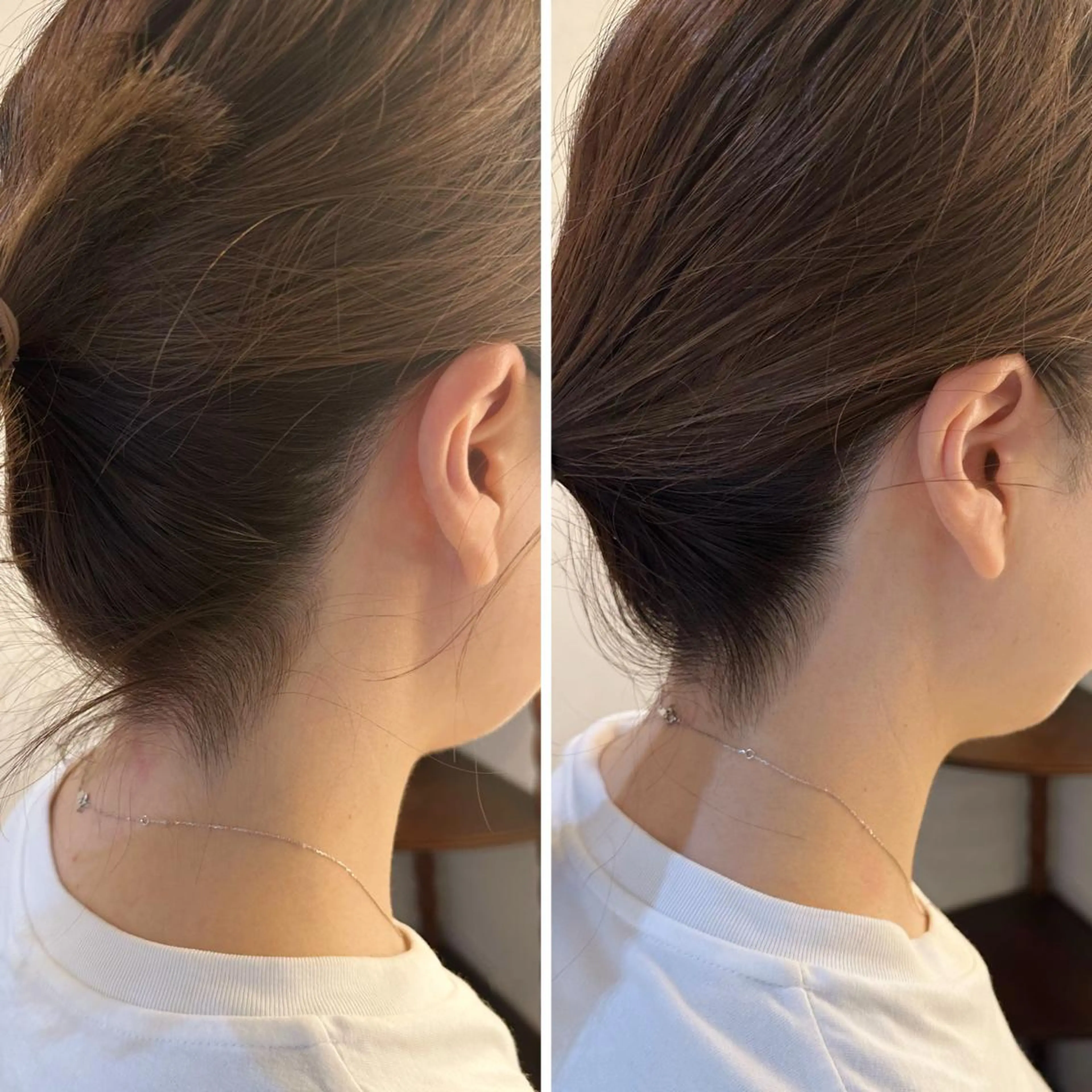 うなじ脱毛/美肌脱毛 LABELのエステ・リラクイメージ