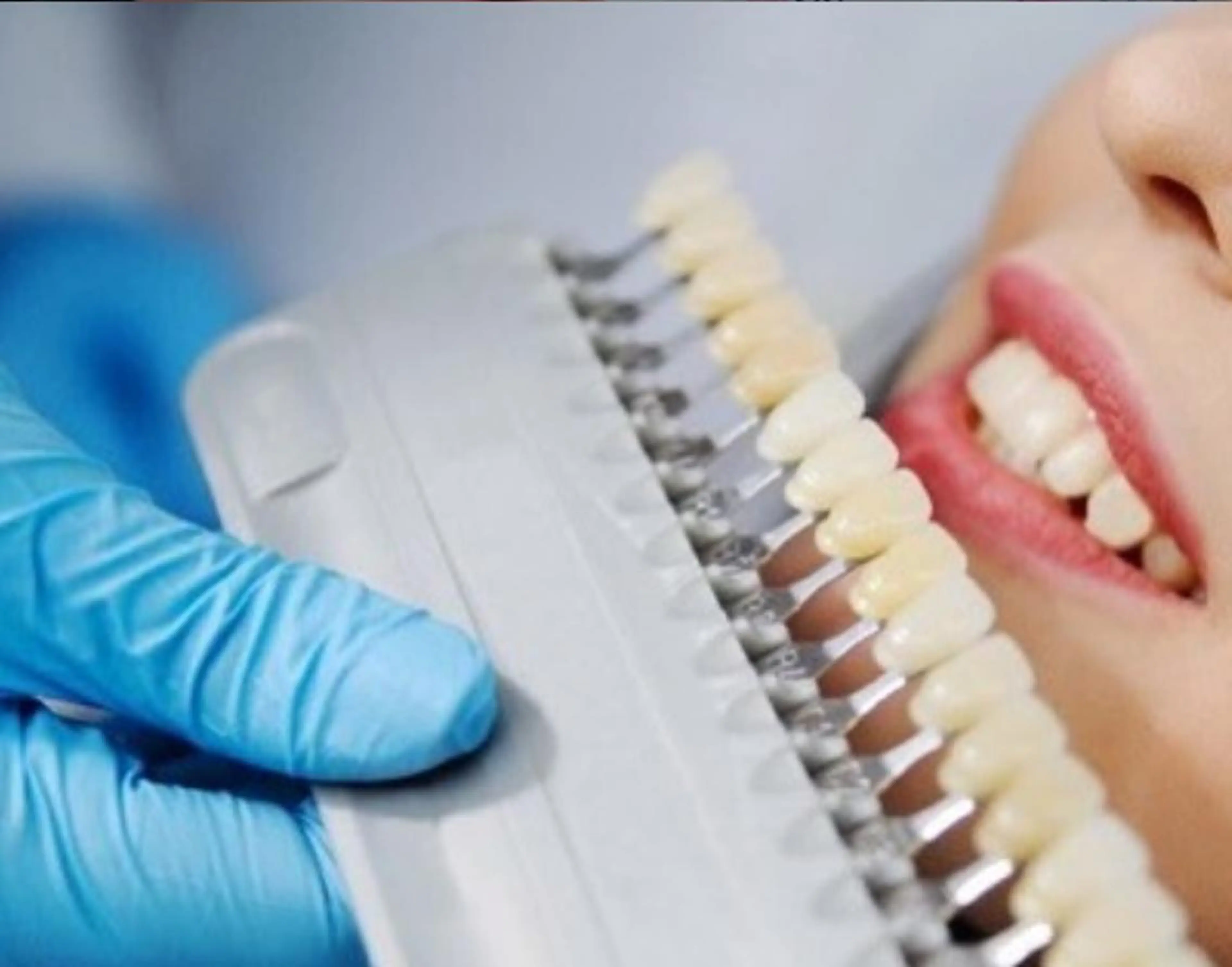 ホワイトニングサロン nico西葛西店のその他イメージ