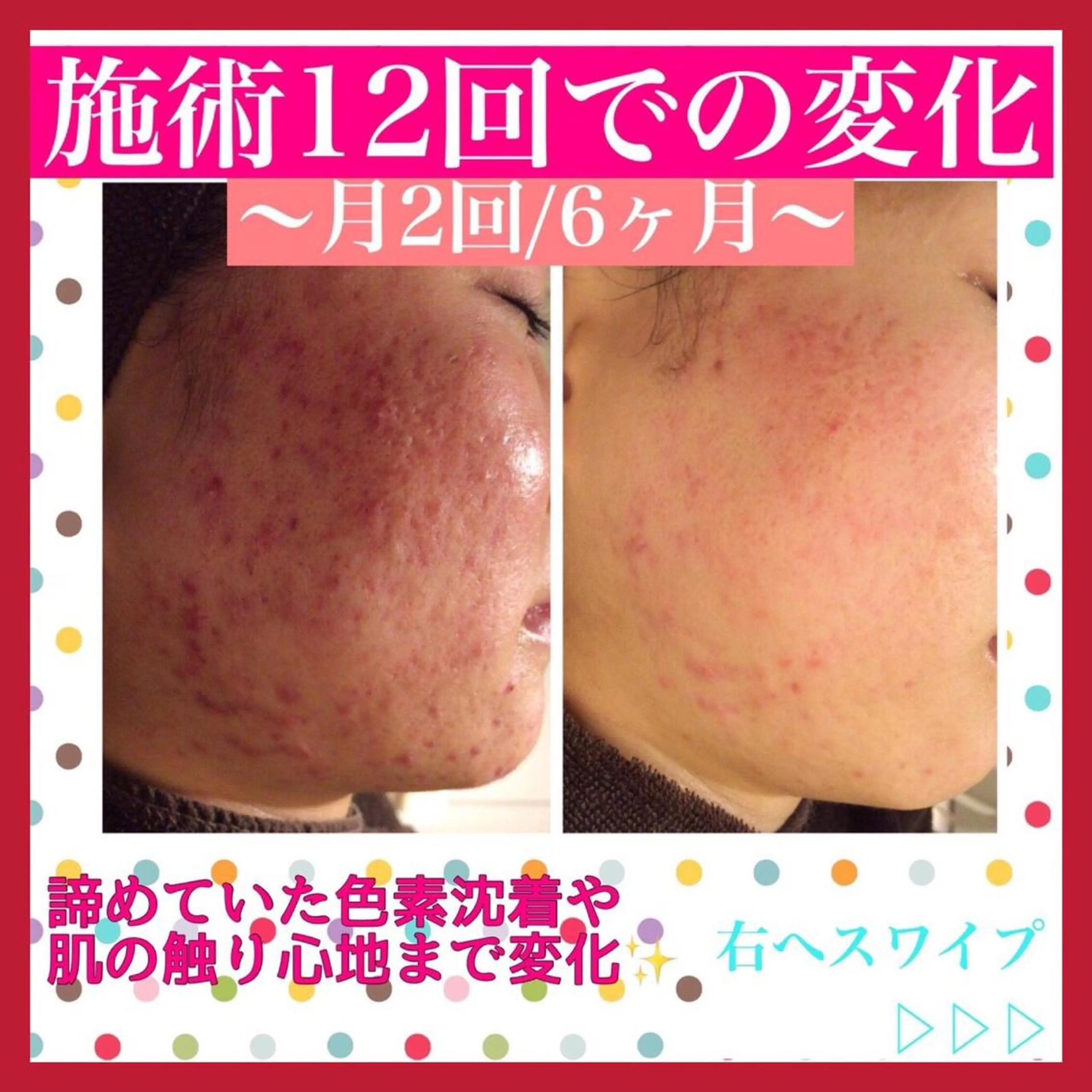 ミディアム カラー パーマ ヘアアレンジ メンズ キッズ ネイル マツエク・マツパ ニキビ・肌質改善専門 ♡人生が変わるサロンのエステ・リラクイメージ