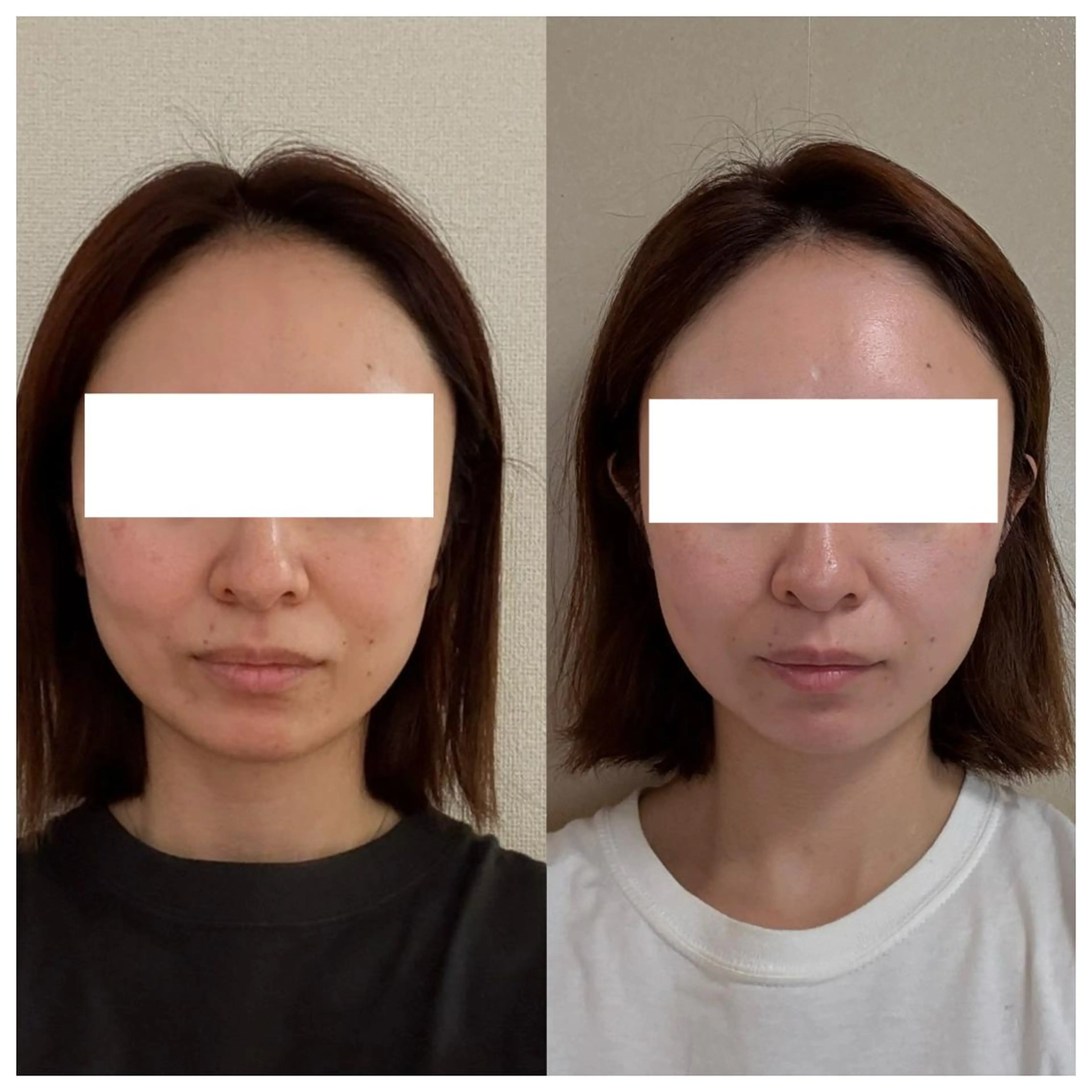 エステ 肌・体質改善専門店 COCO.のエステ・リラクイメージ