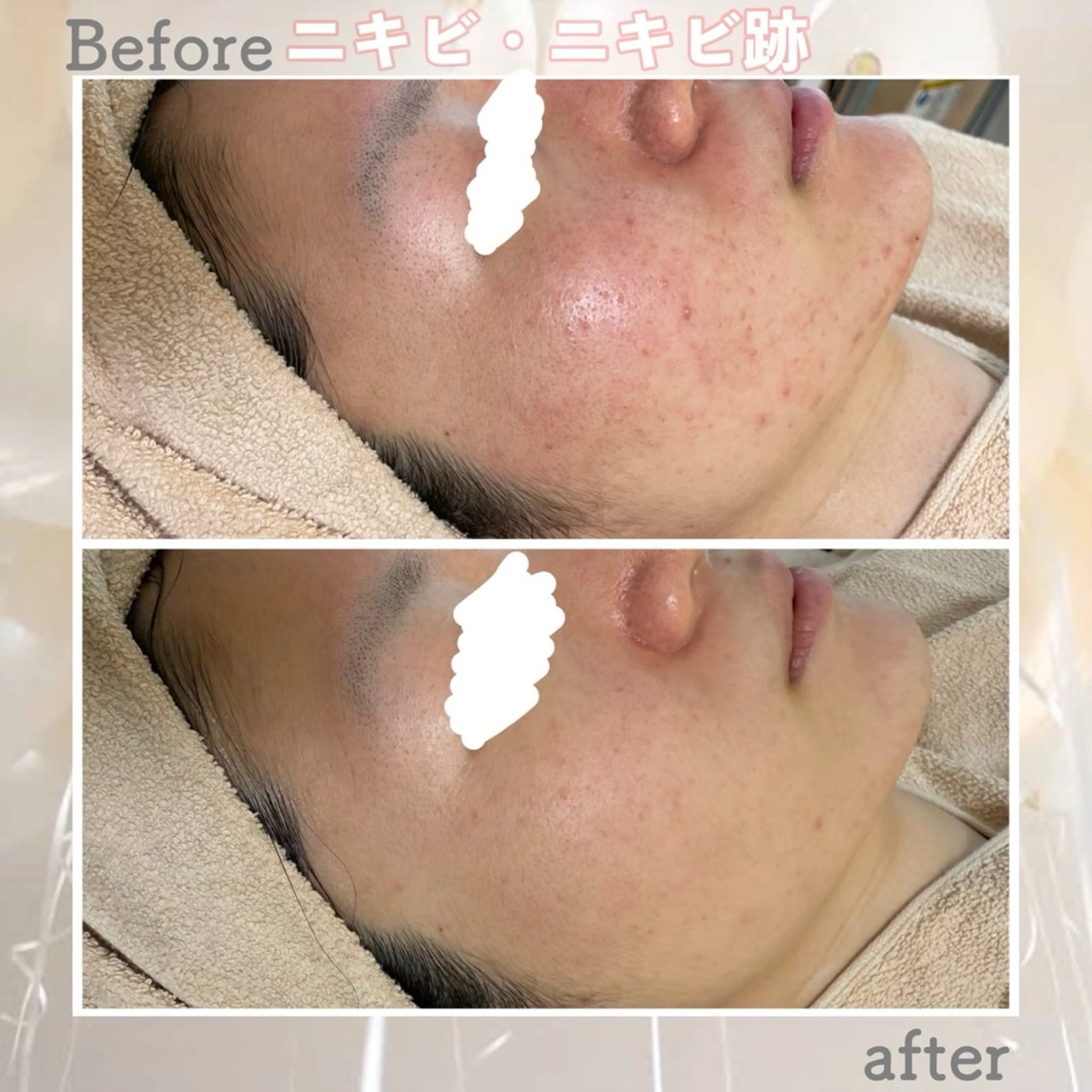 都度払い肌改善専門店 店長二上文香のエステ・リラクイメージ