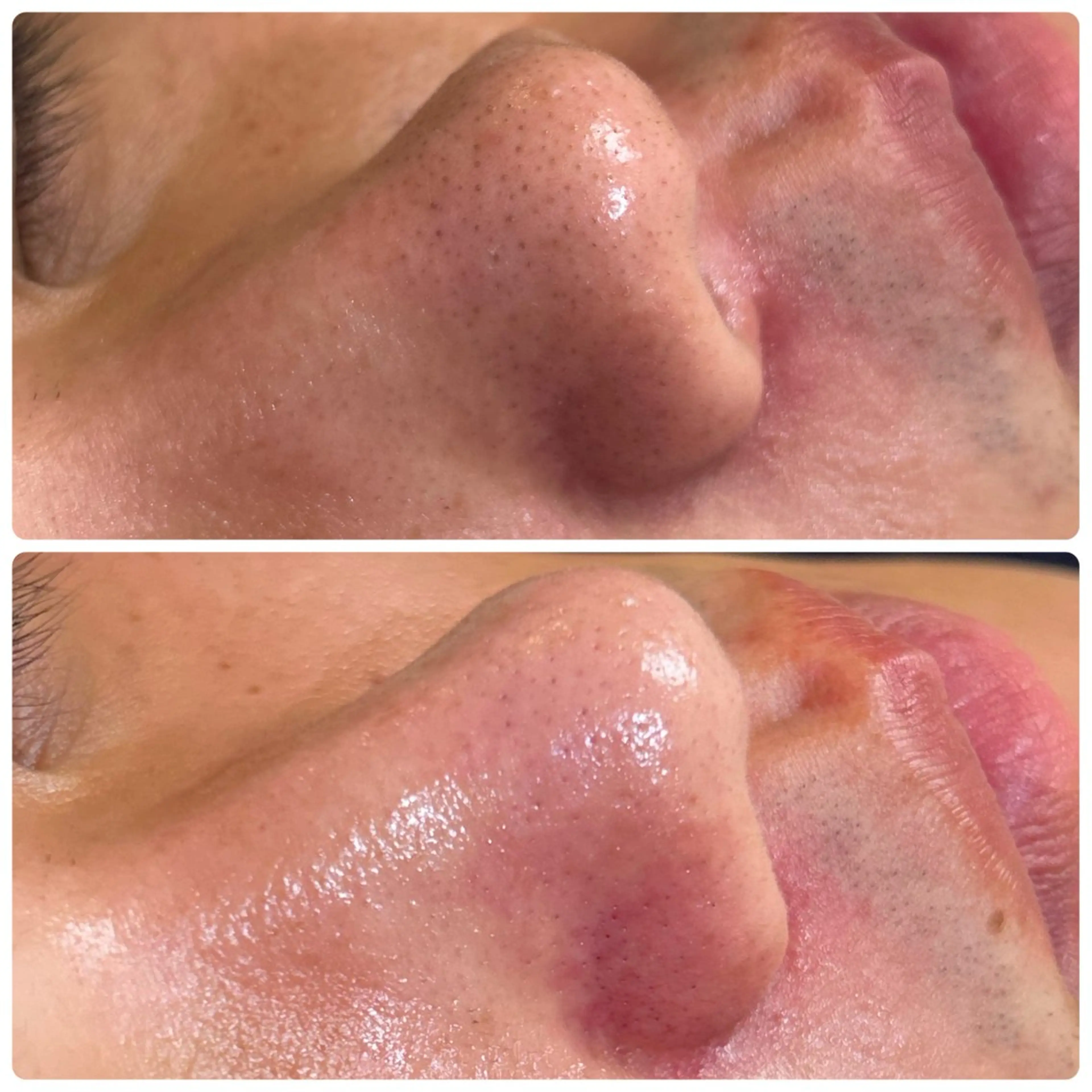 エステ リラク 《美肌･小顔》美容鍼 ＆マッサージ＊MEIのエステ・リラクイメージ