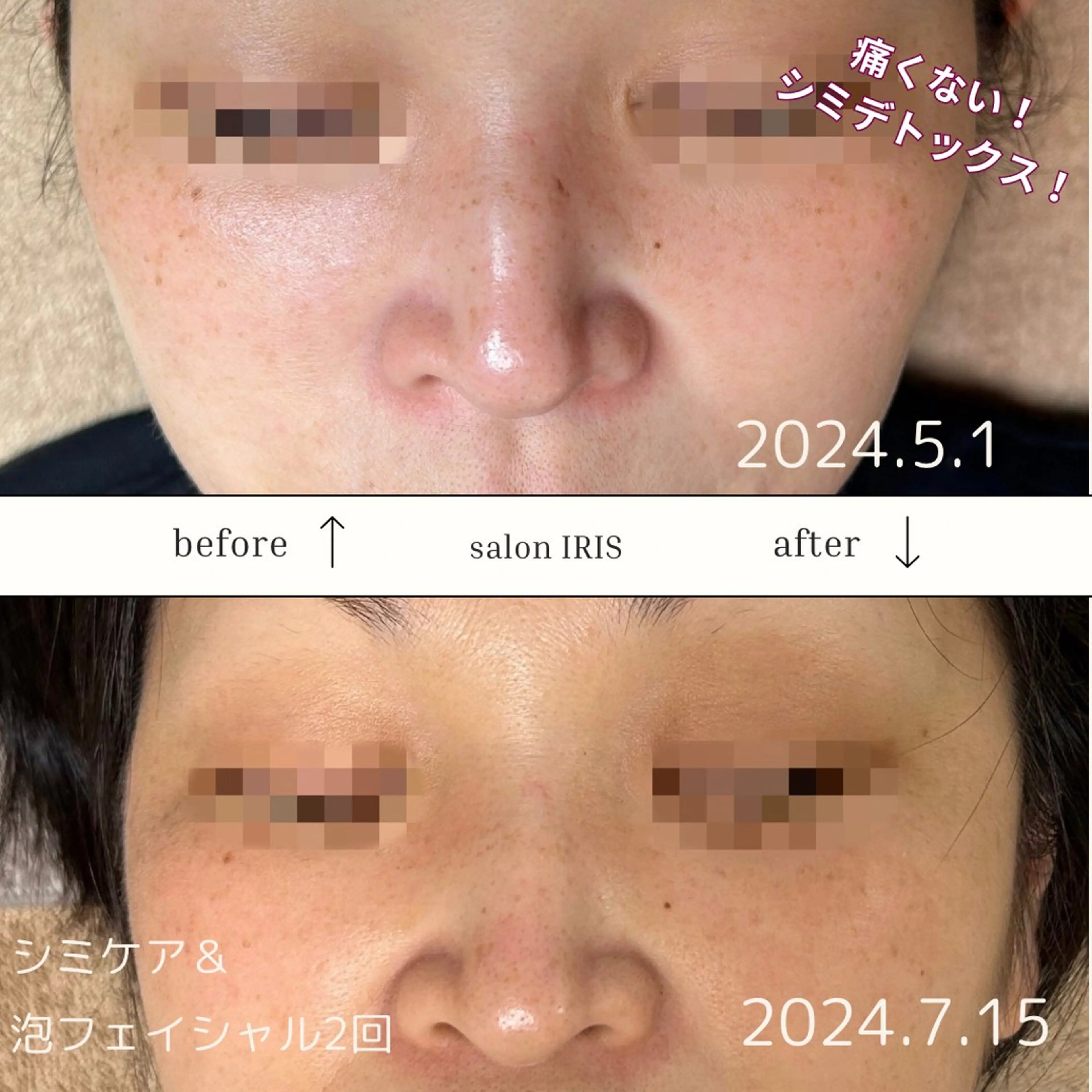 エステ ASAI CHIZURUのエステ・リラクイメージ