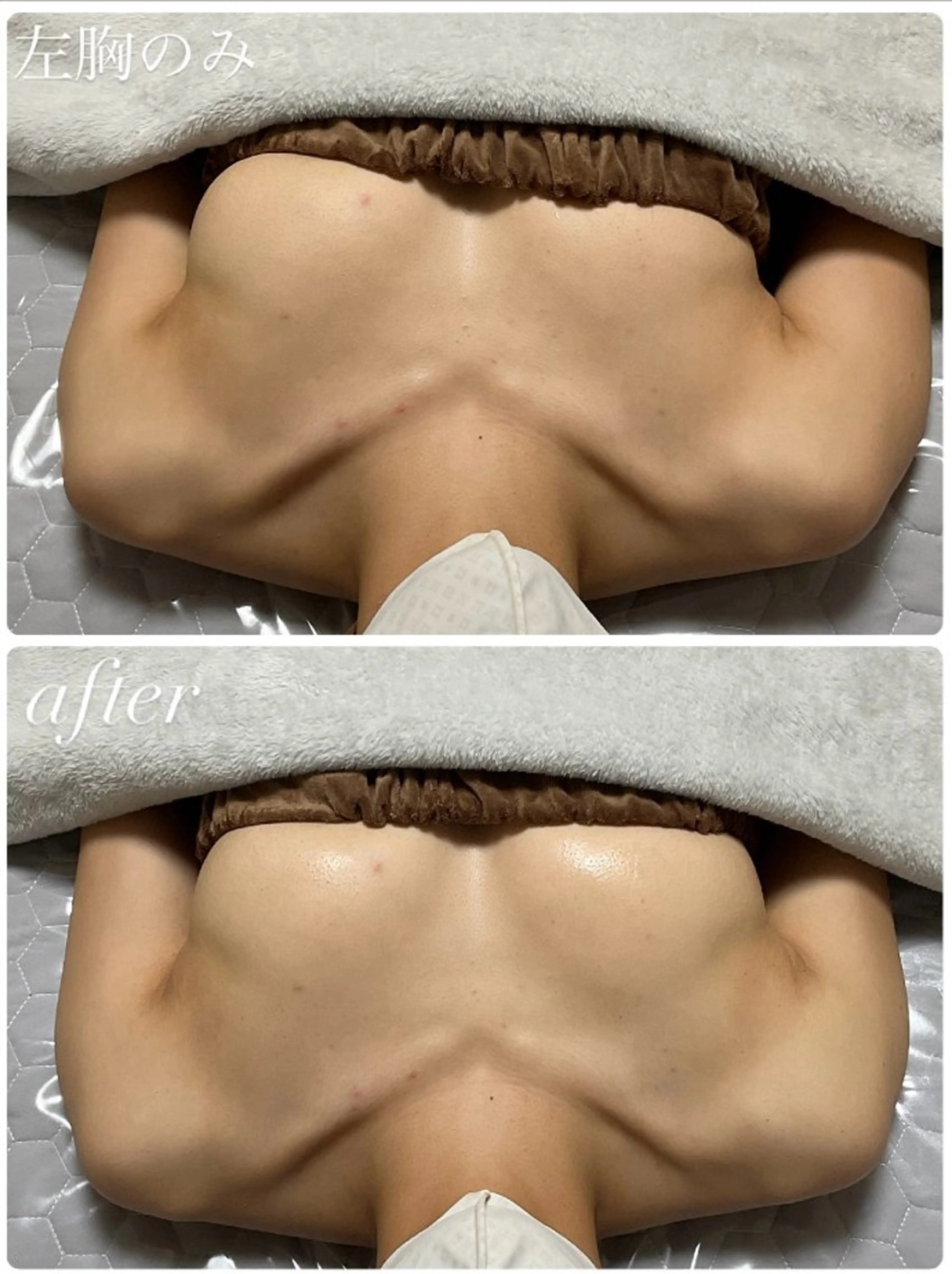 【衝撃バストアップ術】ボリューム/左右差/下垂/ハリ不足様々なお悩みを解決！唯一無二の特殊な技術で本気のバストアップ！！の写真