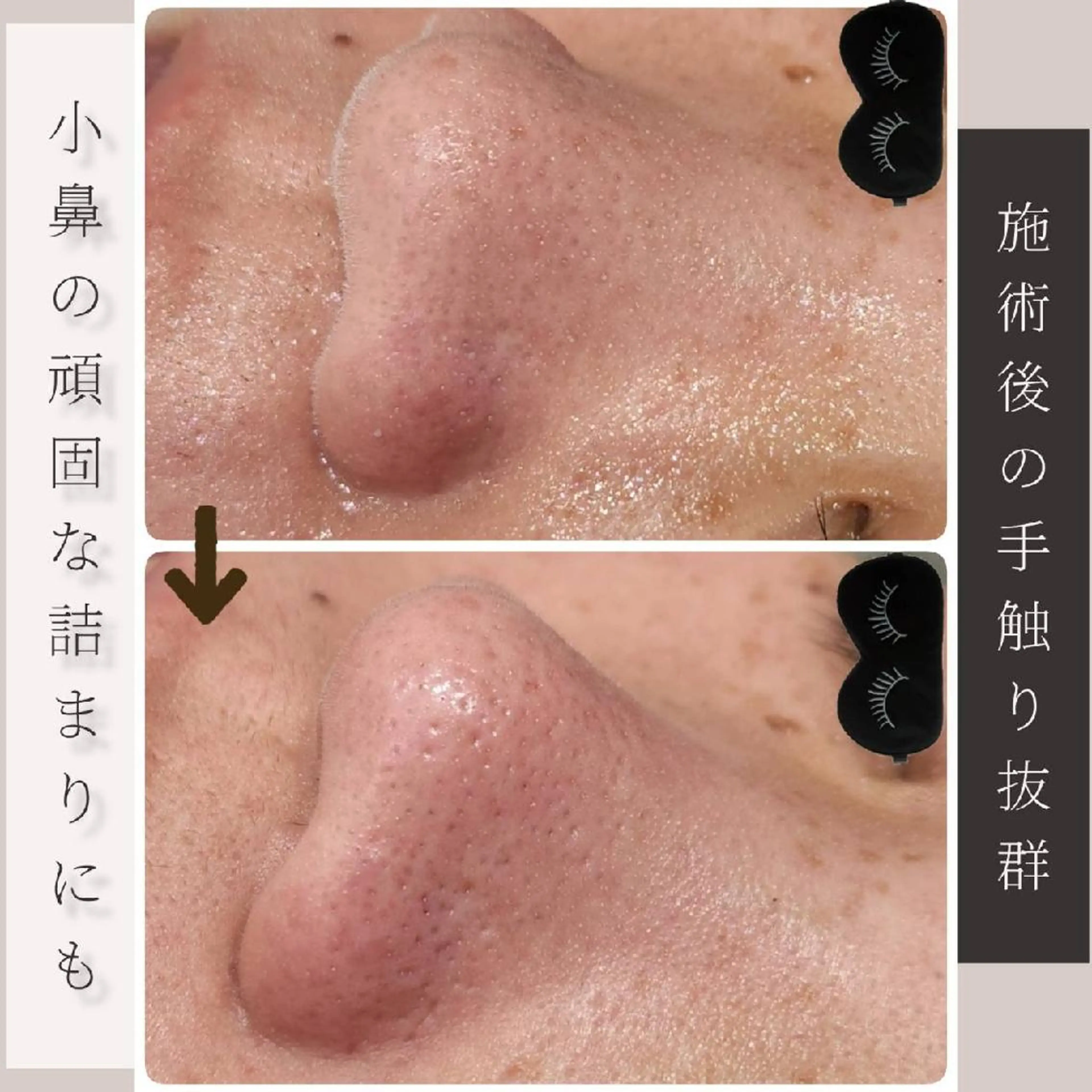 エステ リラク Glossy salonのエステ・リラクイメージ