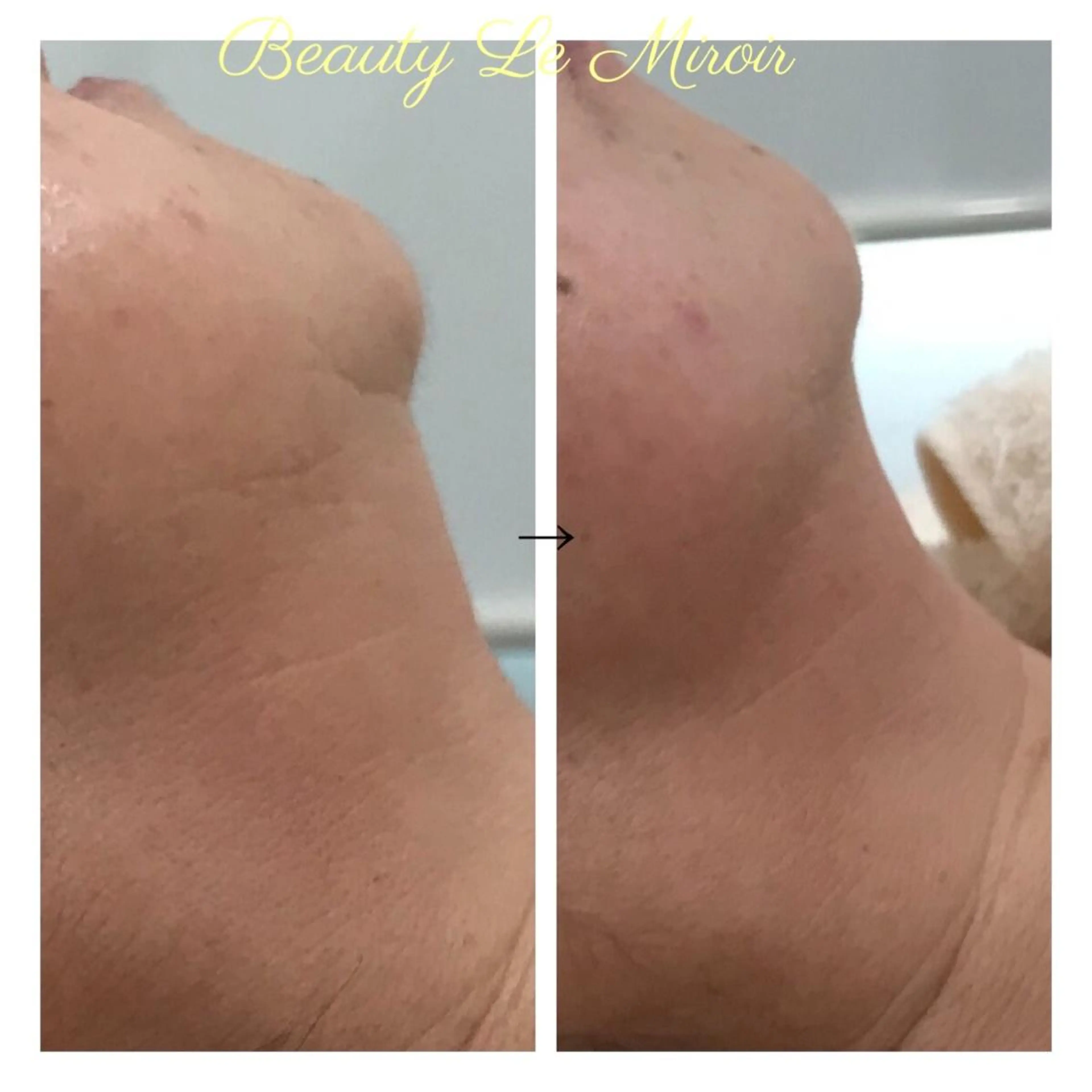 ビューティー ミロワールのエステ・リラクイメージ