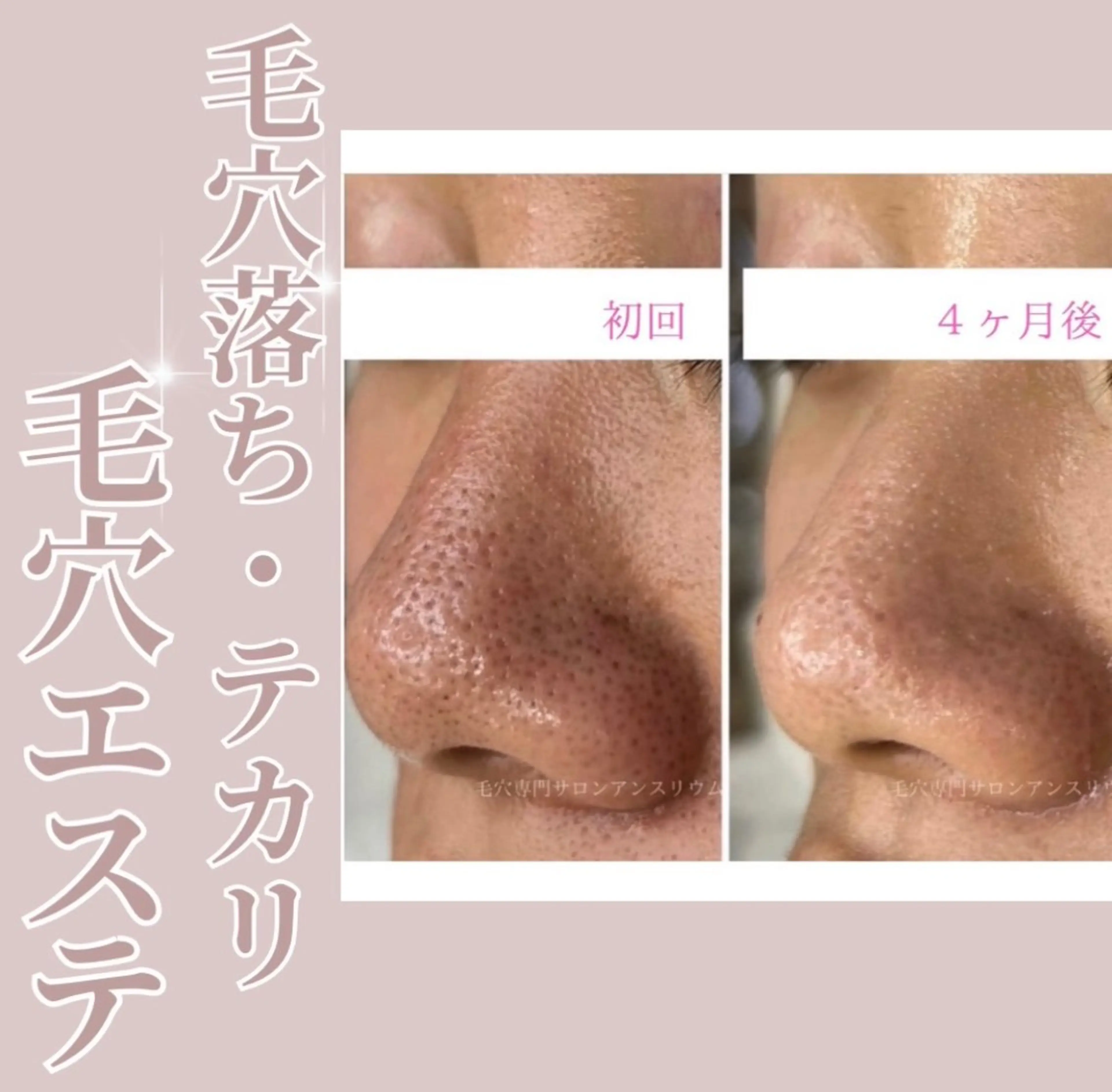 茨城土浦 つくば毛穴 ケア専門サロンのエステ・リラクイメージ